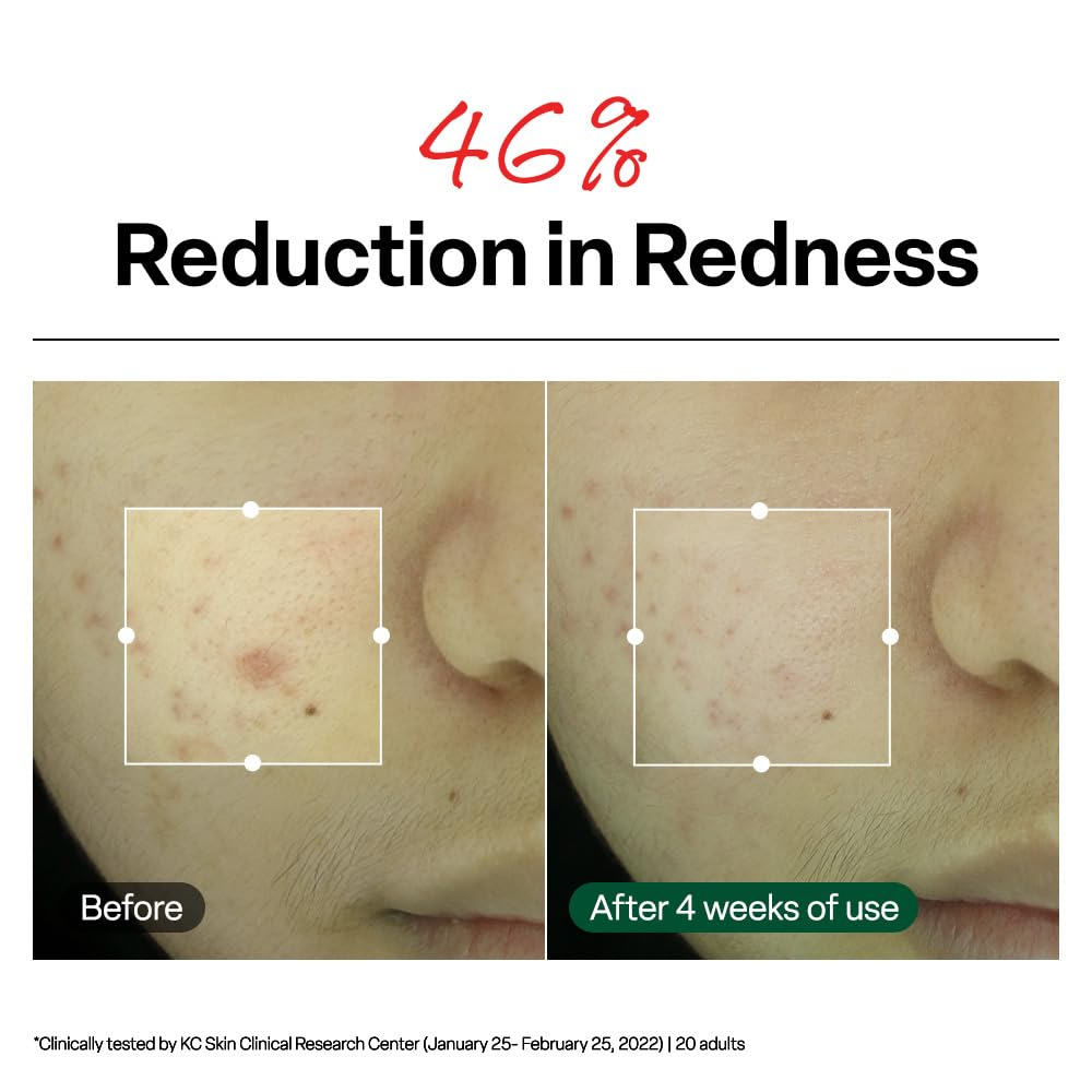 Dr.G R.E.D. Blemish Clear Soothing Face Cream, 2.36 fl oz - Dr.G Official Product View 5