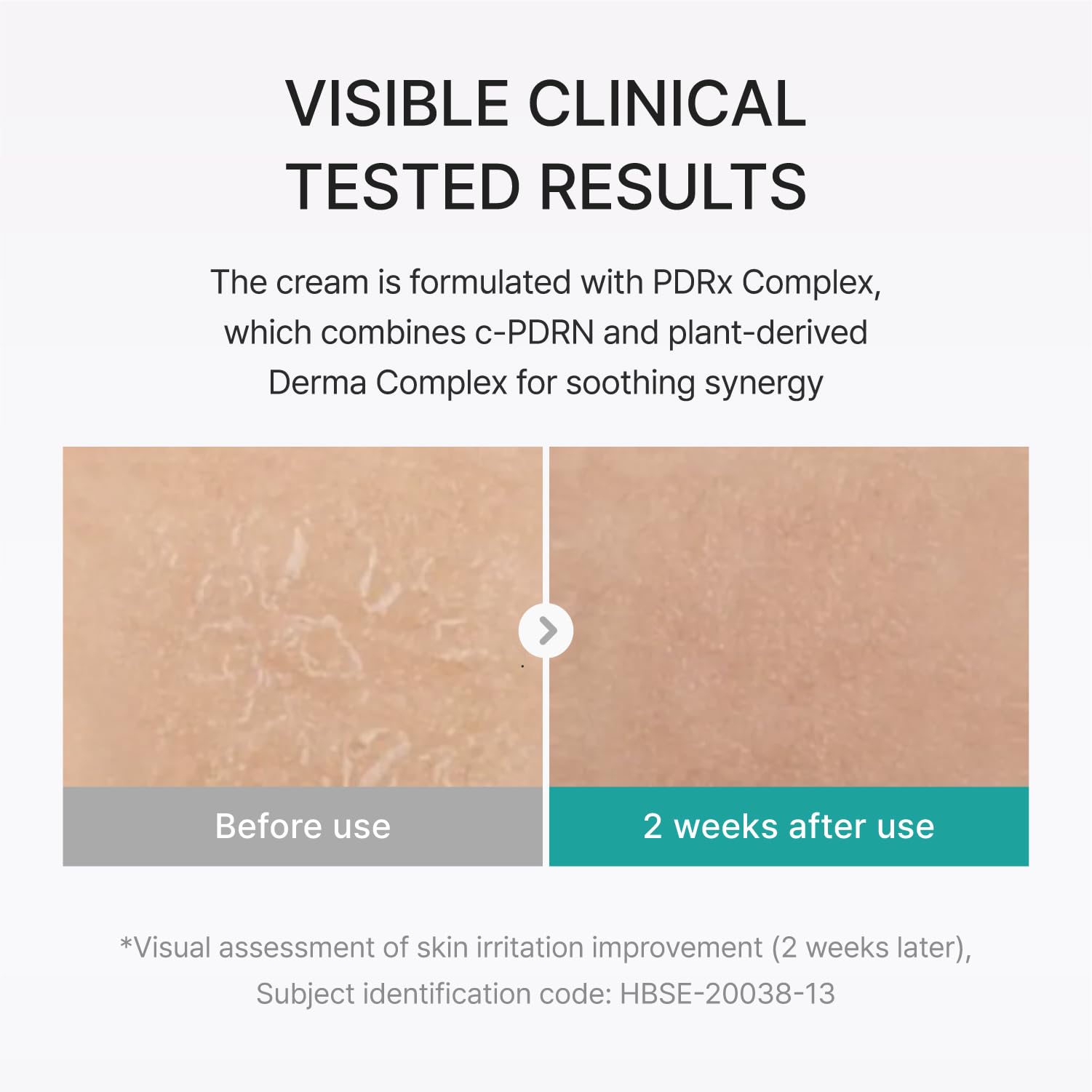 REJURAN® Moisture Cream, c-PDRN® - REJURAN