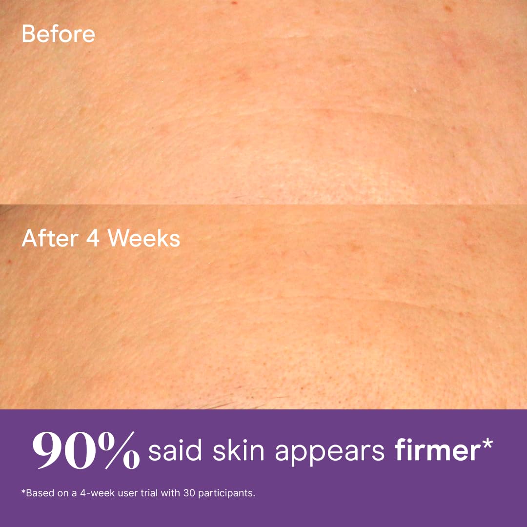 Baebody Retinol Cream for Face - With Jojoba Oil & Vitamin E - Baebody Official Product View 9