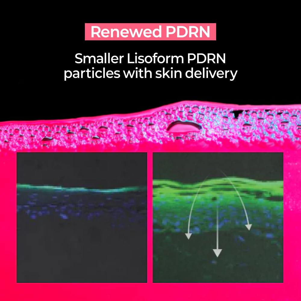 PDRN+ Lifting Face Mask, Collagen Peptides, Skin Firming &amp; - ZIGTAG