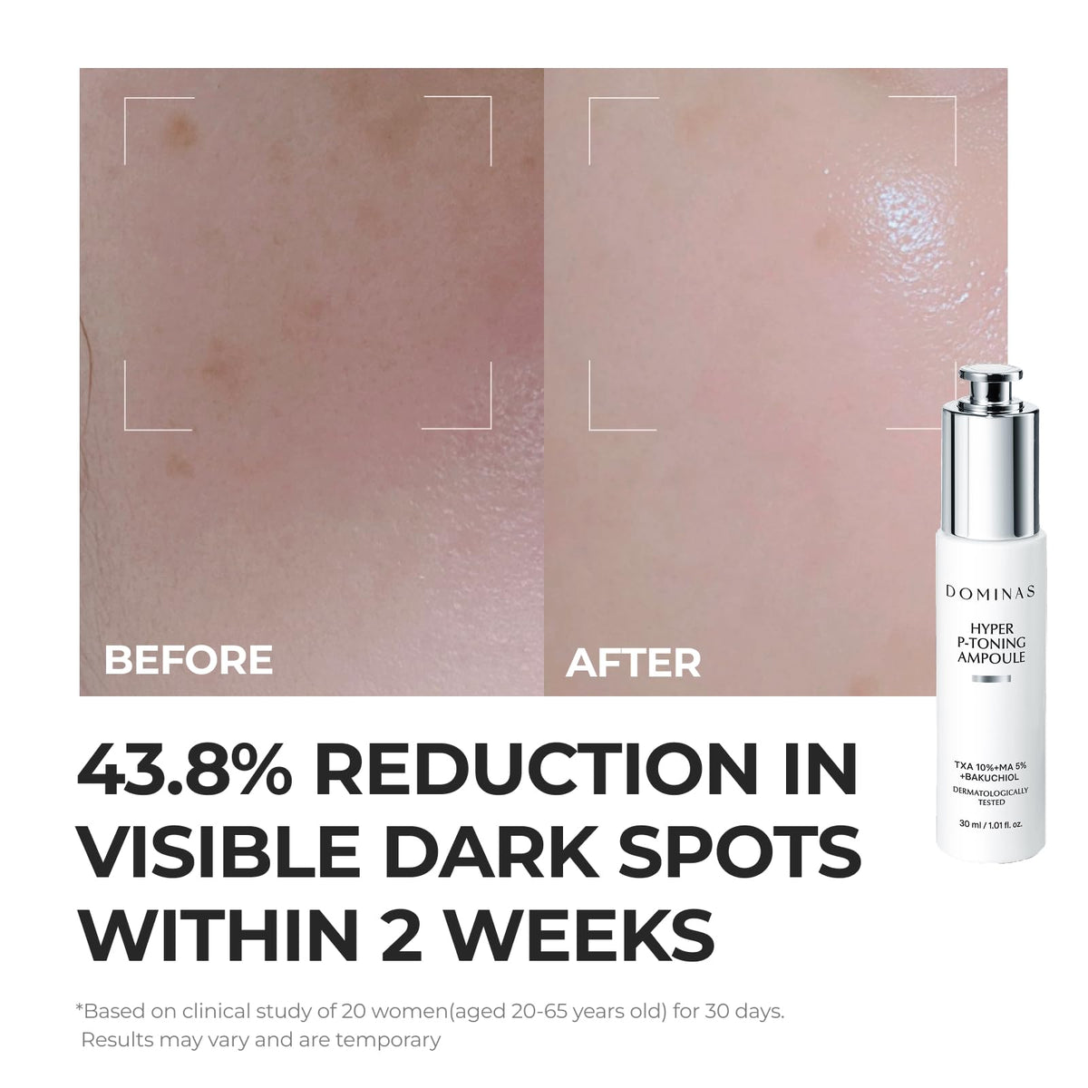 DOMINAS TXA Hyper P Toning Serum 30ml - DOMINAS Official Imagery - 5