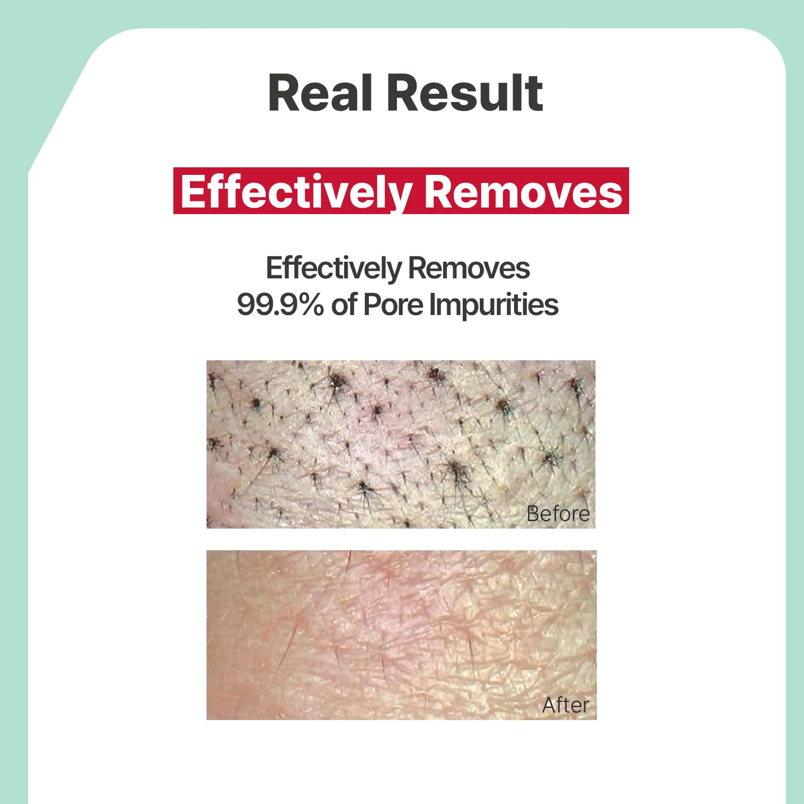 Illiyoon Gentle Deep Facial Cleanser - Low pH Gel Foam Face Wash for Sensitiv - Illiyoon Official Product View 5