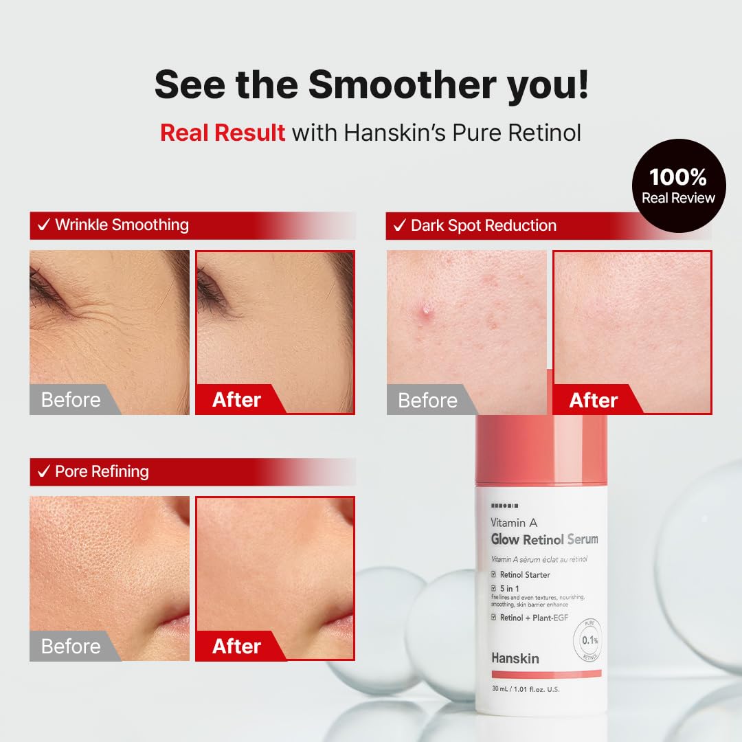 Hanskin Retinol Power Duo – Vitamin A Glow Serum &amp; Cream - Hanskin