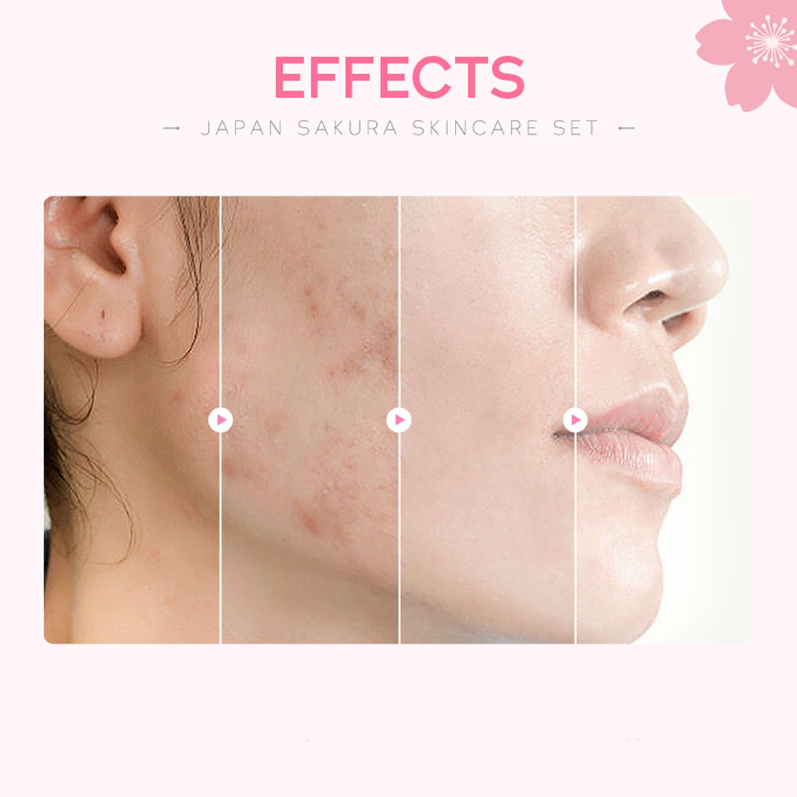 Skin Care Set, Cherry Facial kit for women, Skincare Kit Gifts - Etuanxi