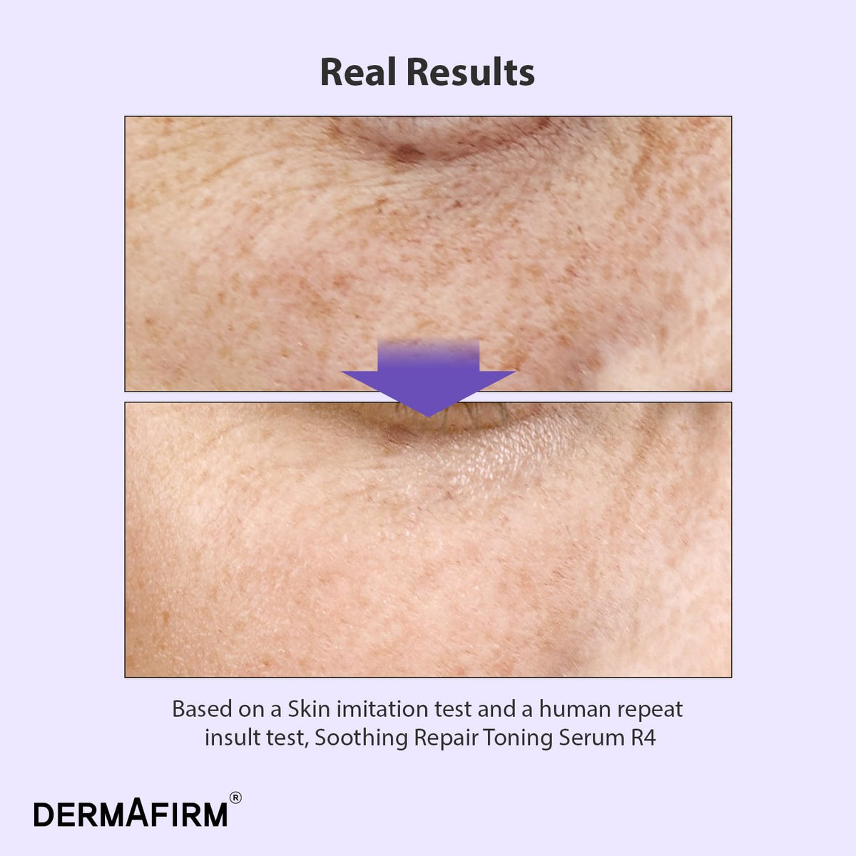 Dermafirm Soothing Repair Toning Serum R4 1 01 fl oz - Dermafirm Official Product Imagery - 4