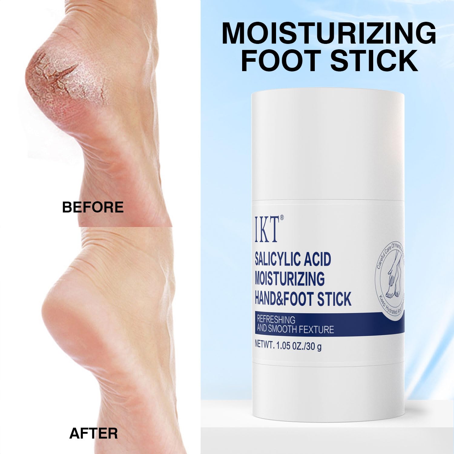 PasaRose Heel Crack Care & Moisturizing Set, Includes a pair of moisturizing heel socks and a professional heel repair stick. deeply treats dry and cracked feet