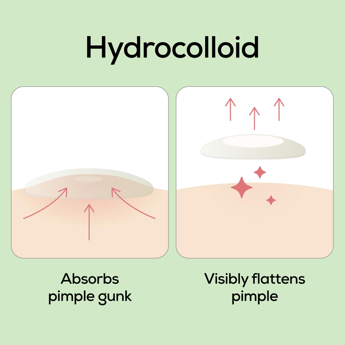 HANHOO Soothing Blemish Patch with Aloe Madecassic Acid and - HANHOO Official Imagery - 7
