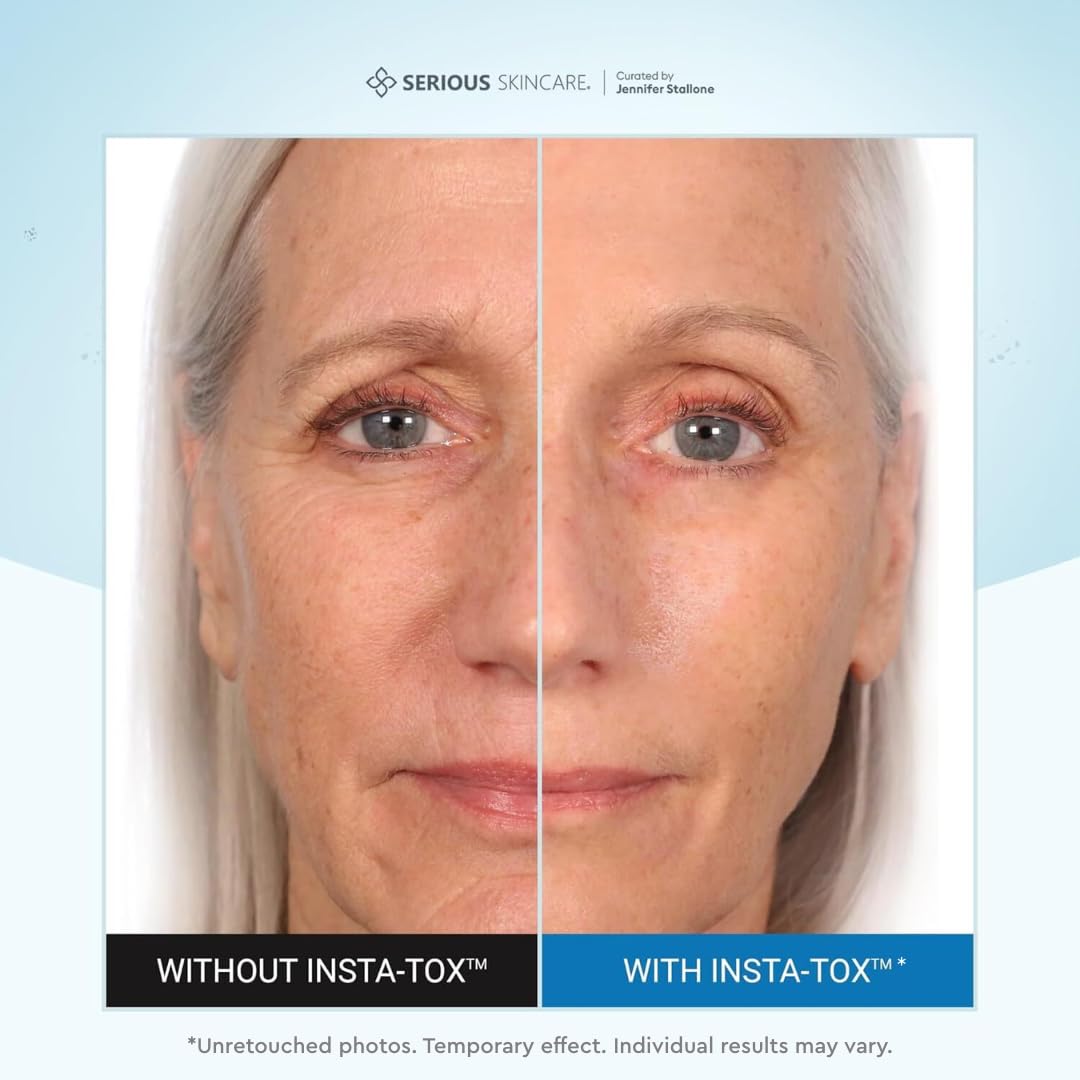 Serious Skincare INSTA TOX Instant Wrinkle Filler Face Serum - Serious Skincare Official Imagery - 3