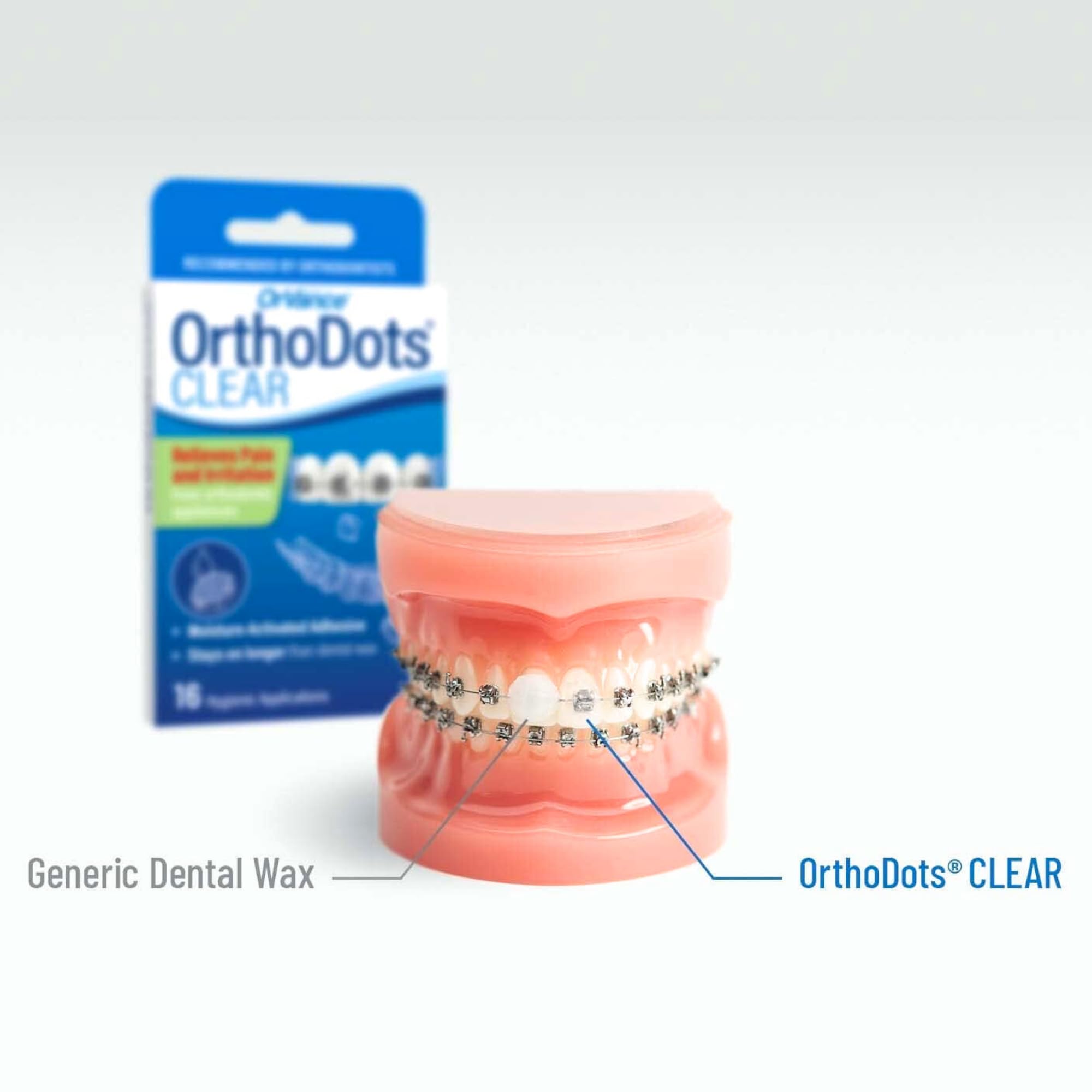 OrthoDots CLEAR Braces Wax Alternative by ORVANCE