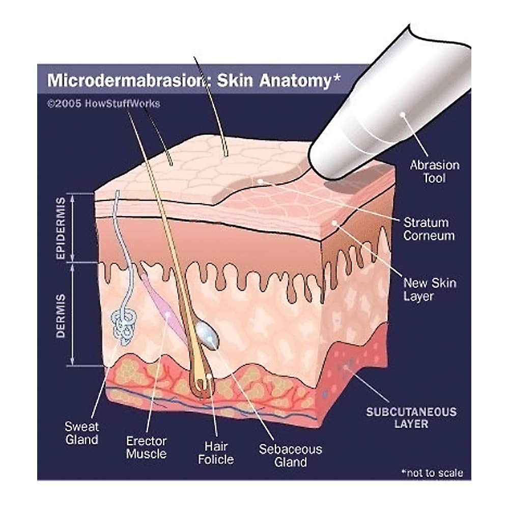 Microdermabrasion Crystals for Machines, All-Natural Facial - NeedCrystals