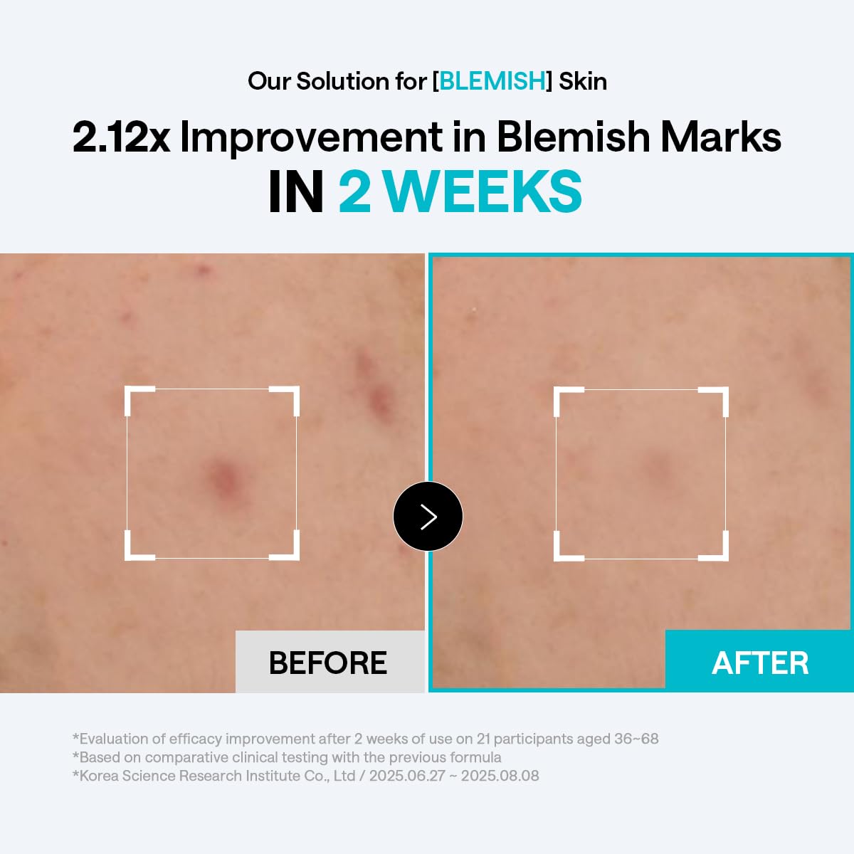 MEDIHEAL Madecassoside Blemish Care Toner Pad - MEDIHEAL Official Imagery - 6