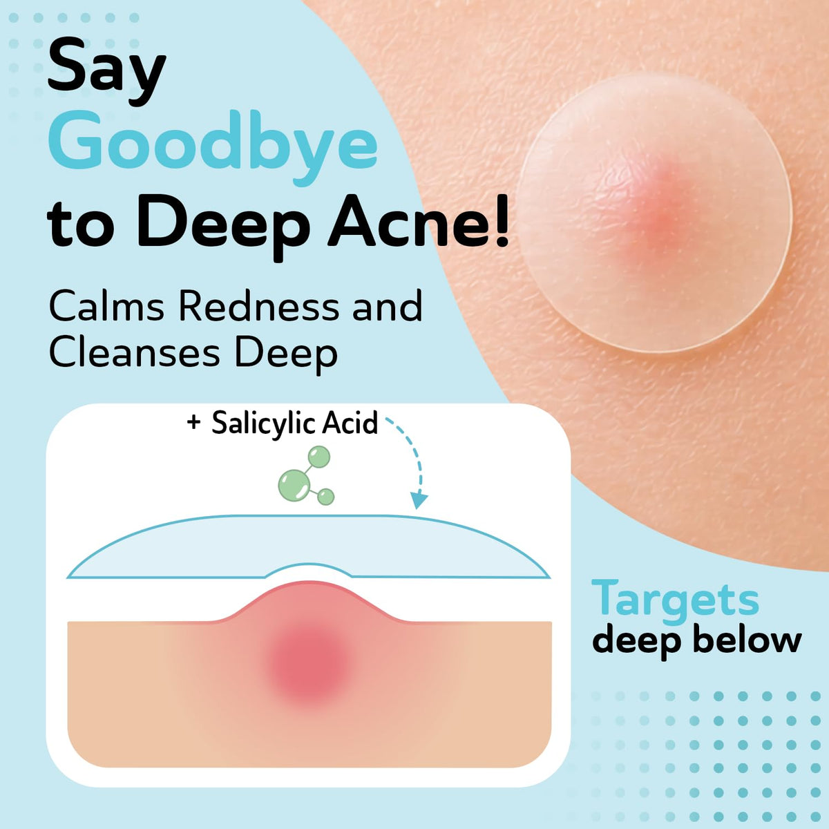 Invisible Salicylic Acid Pimple Patches for Face - DERMA ANGEL Official Imagery - 4