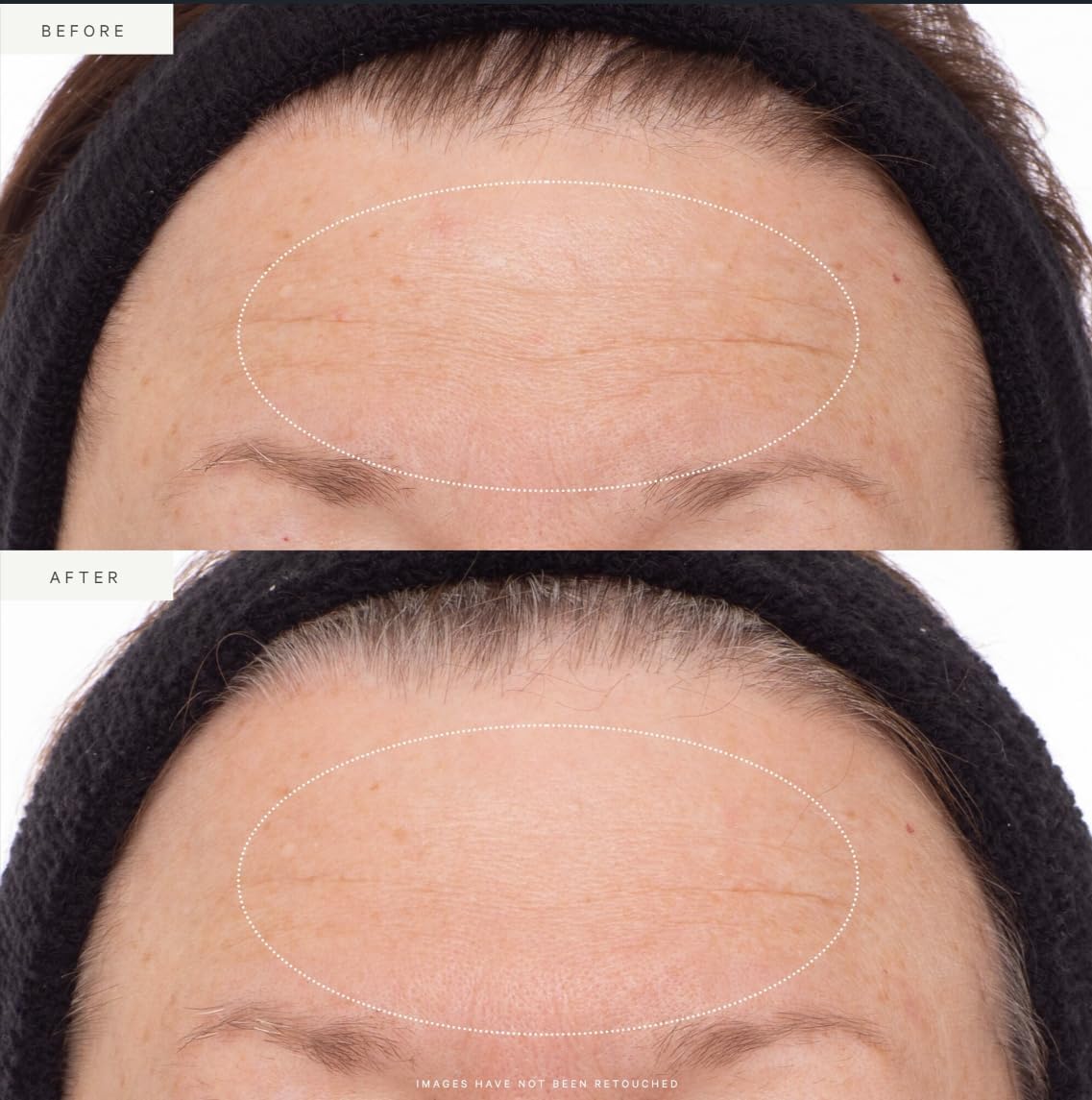 KORA Organics Plant Stem Cell Retinol Alternative Serum, Firming Face Serum - KORA Organics Official Product View 3