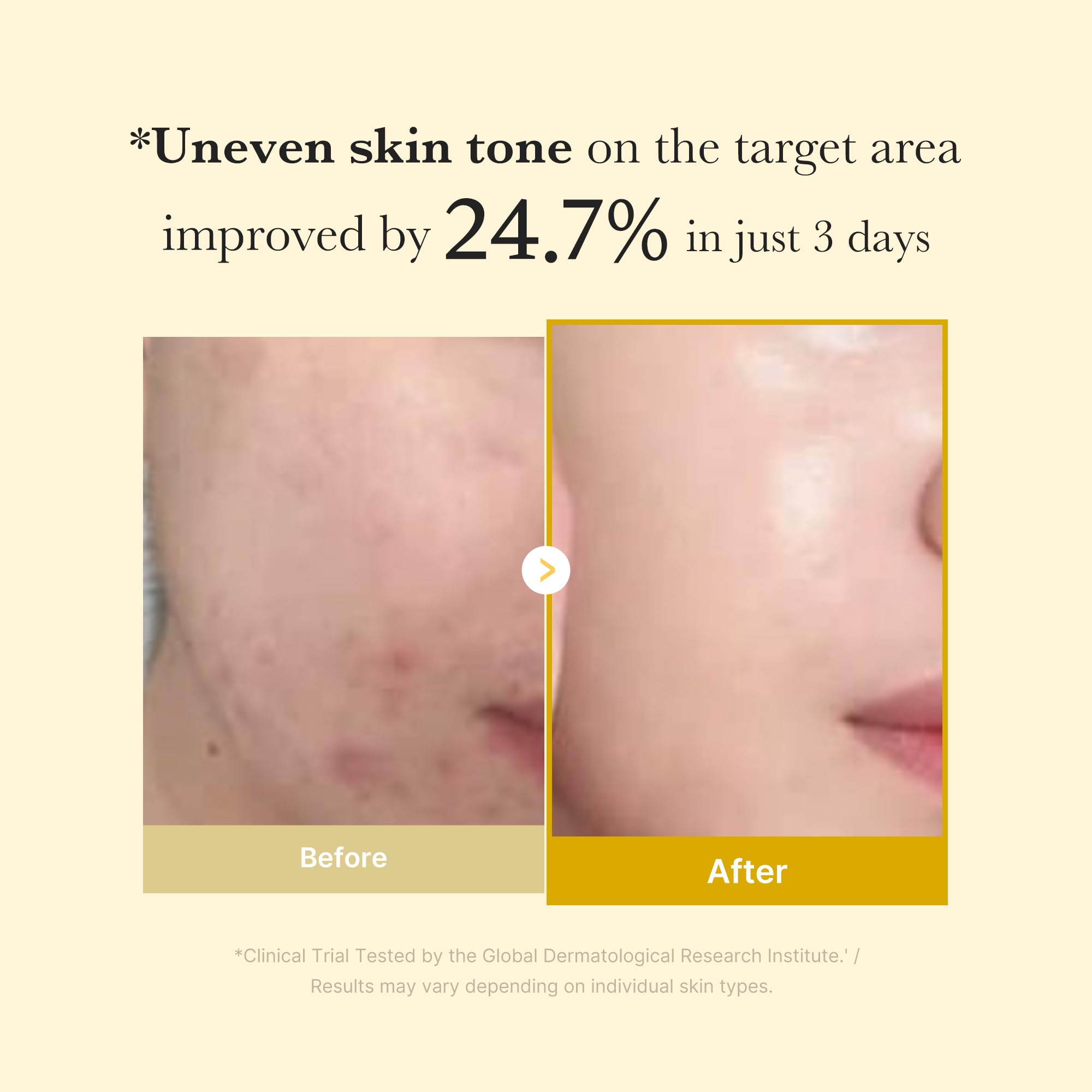 medicube Kojic Acid Turmeric Overnight Wrapping Peel Off Mask – - medicube