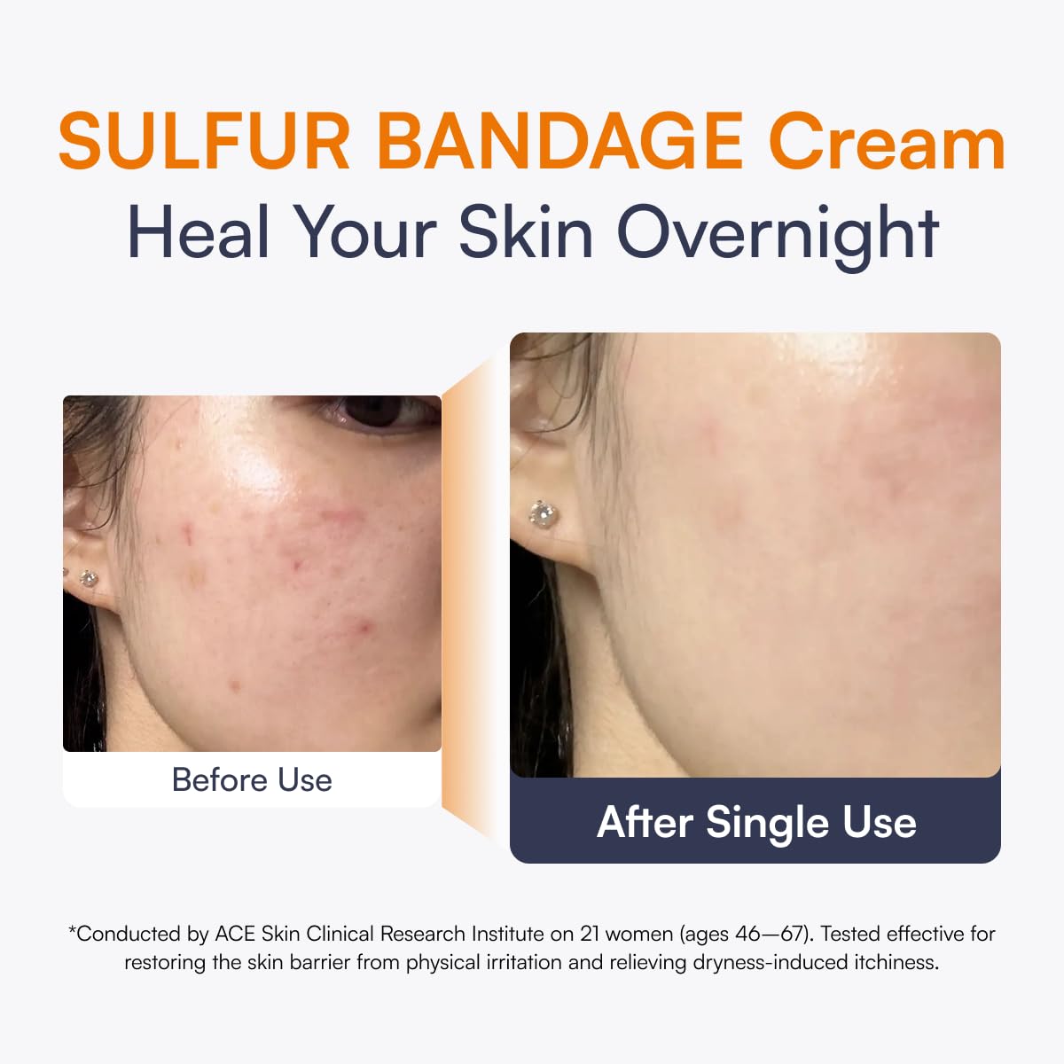 Abso BIO BAND REPAIR Cream Daily Post Treatment Skin Barrier - Abso. Official Imagery - 4