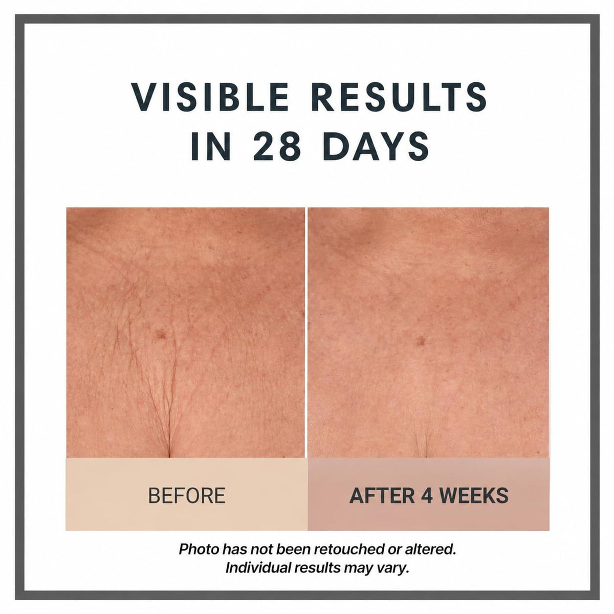Consult Beaute Champagne Lift Hydrating Firming Body Cream - Consult Beaute Official Imagery - 5