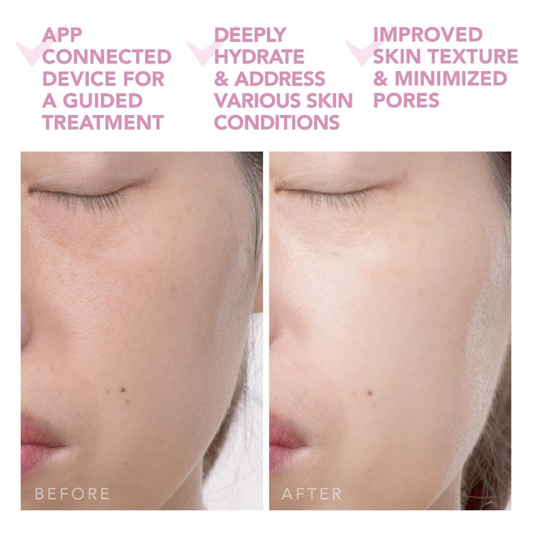FOREO UFO 2 Supercharged Face Mask - FOREO