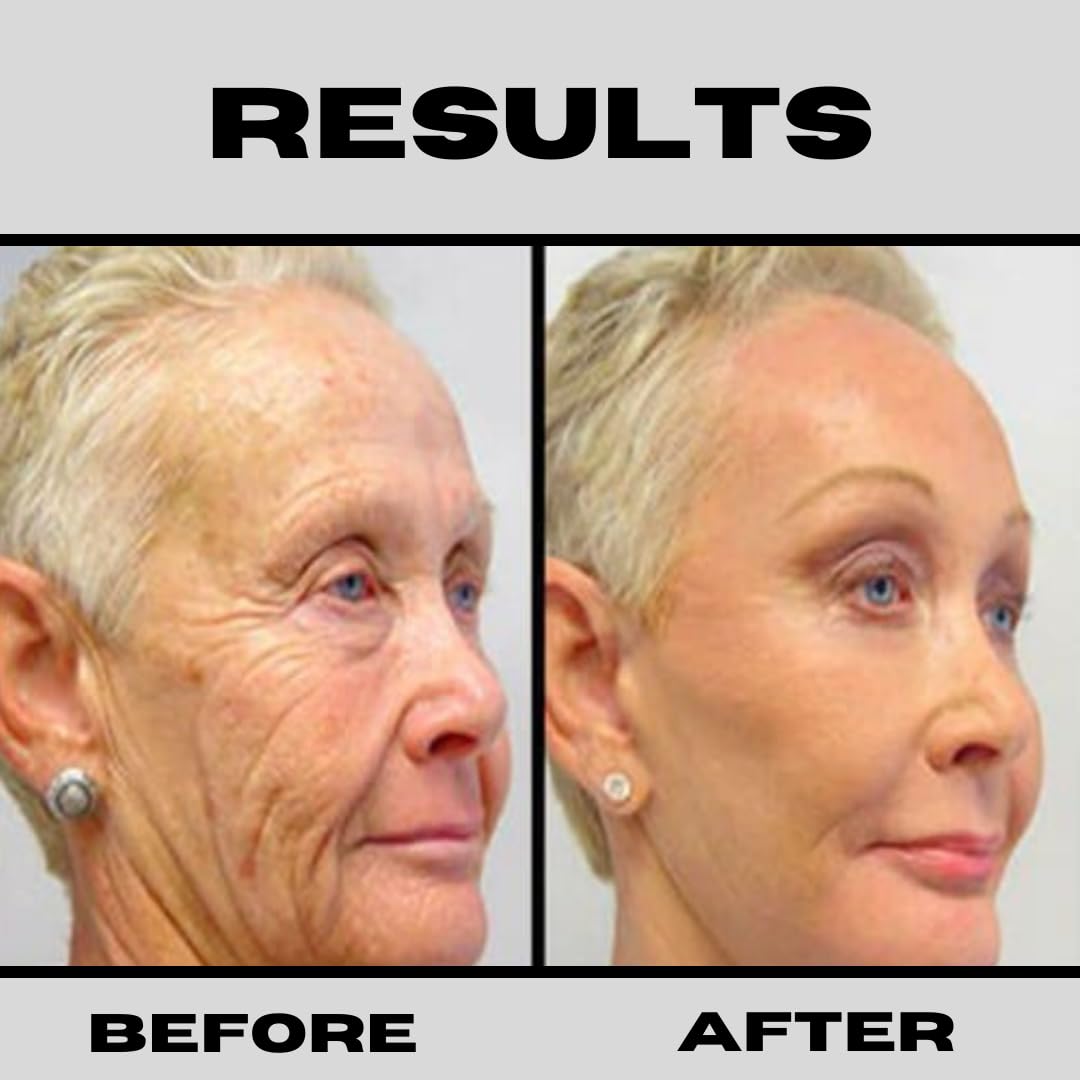 Retinol Niacinamide B3 Vitamin C Hyaluronic Acid Serum Anti - DERMA CLINICALS Official Imagery - 5