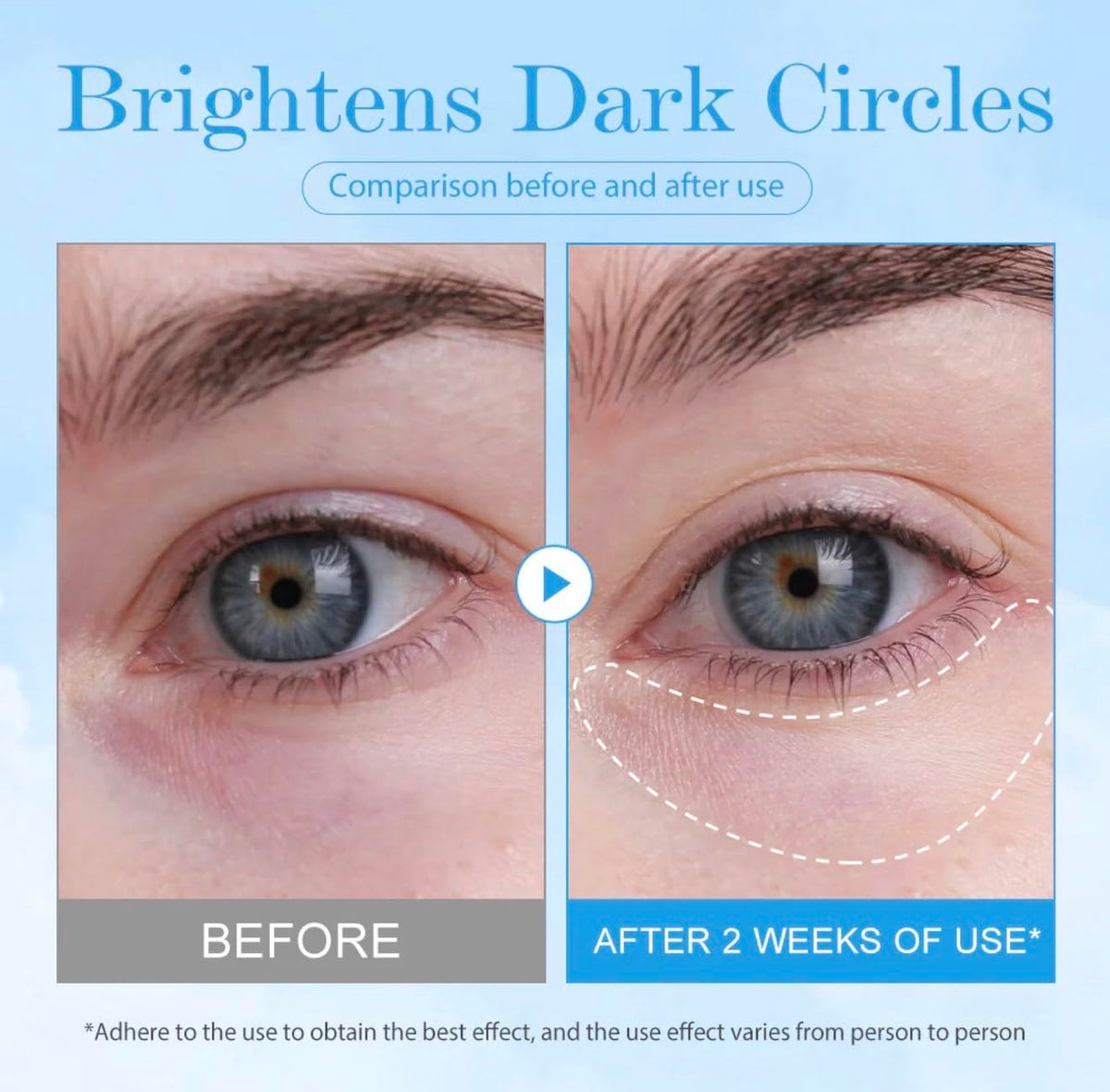 Bomb Cooling Eye Gel Hydrating Under Eye Gel for Dark Circle - BEAUTIVANA Official Imagery - 4