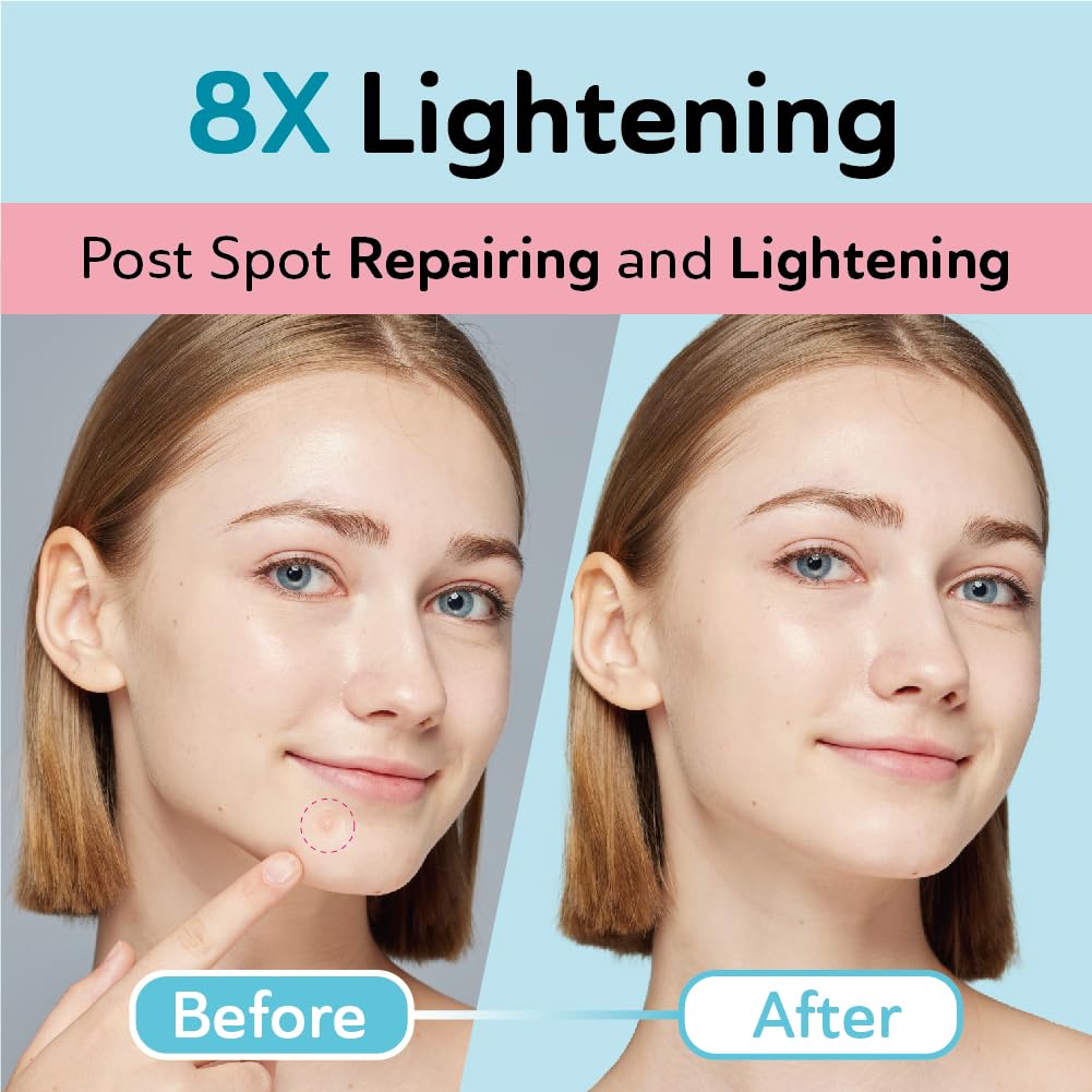 Dark Spot Patches Blemish Patches with Hydrocolloid TXA CICA - DERMA ANGEL Official Imagery - 3