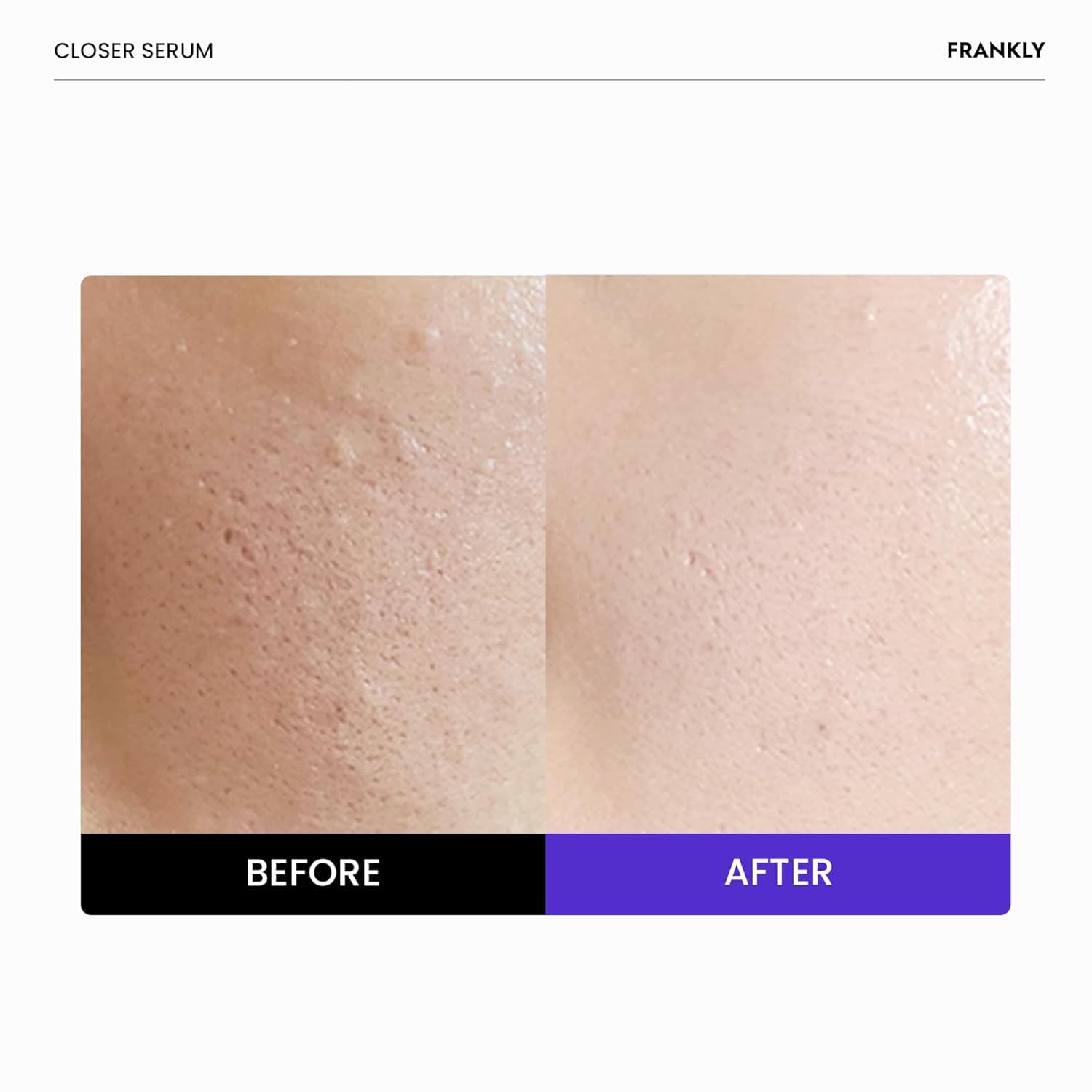 FRANKLY Closer Serum - FRANKLY