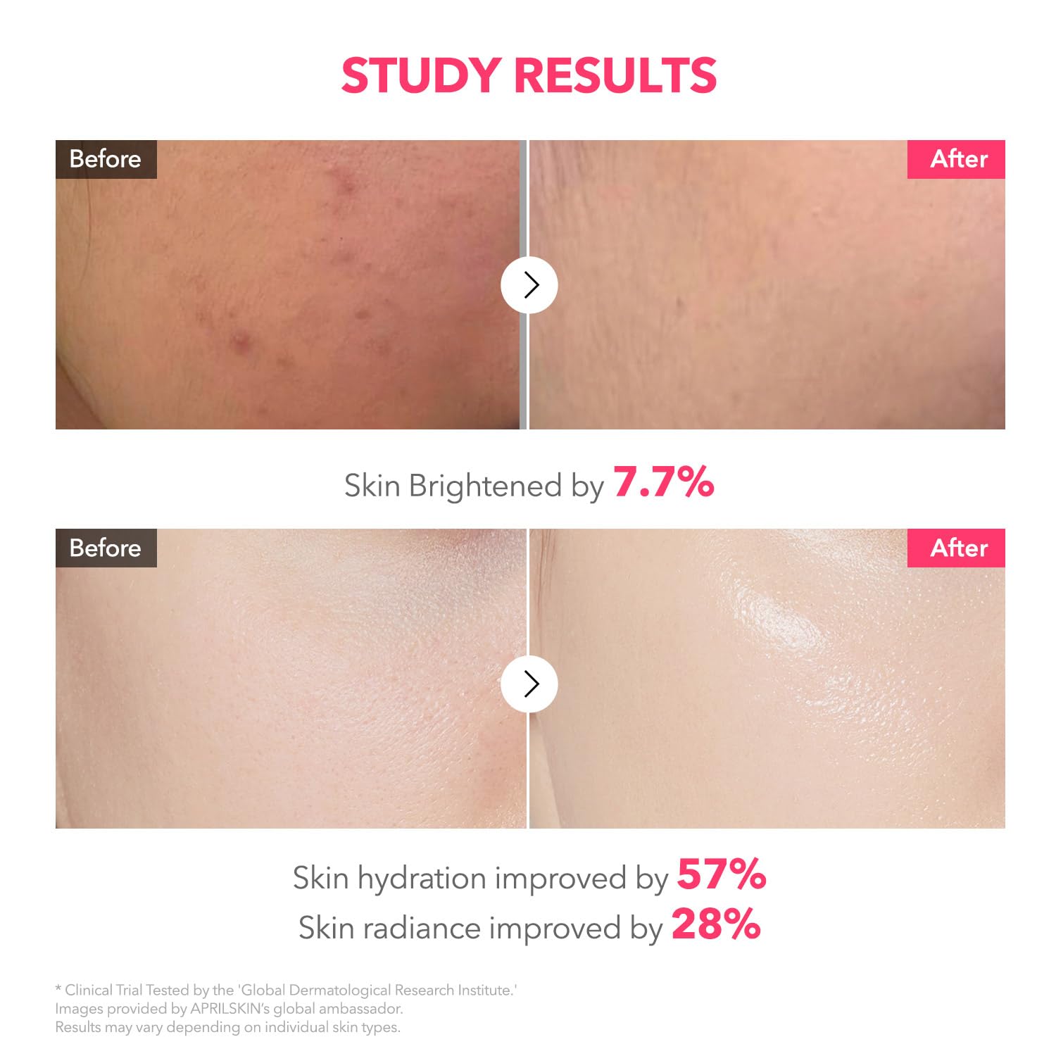 APRILSKIN TXA Pink Capsule Gel Mask 4EA - APRILSKIN