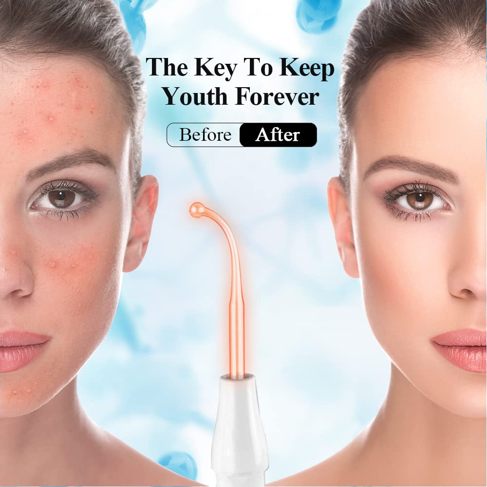 Face Skin Care Wand FAZJEUNE High F requency Facial Device - FAZJEUNE Official Imagery - 5