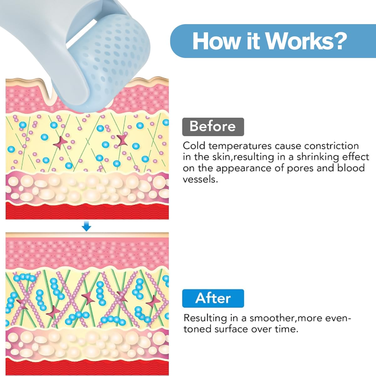 Fronnor Ice Roller for face and eyes, cooling massager with a sleek handle and spherical roller for soothing skincare.