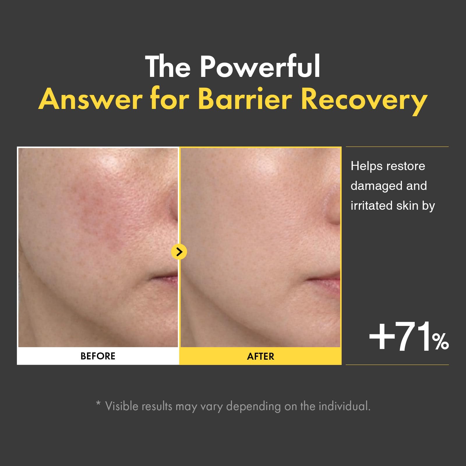TOSOWOONG Ceramide Barrier Cream for Dry Sensitive Skin - TOSOWOONG Official Imagery - 3