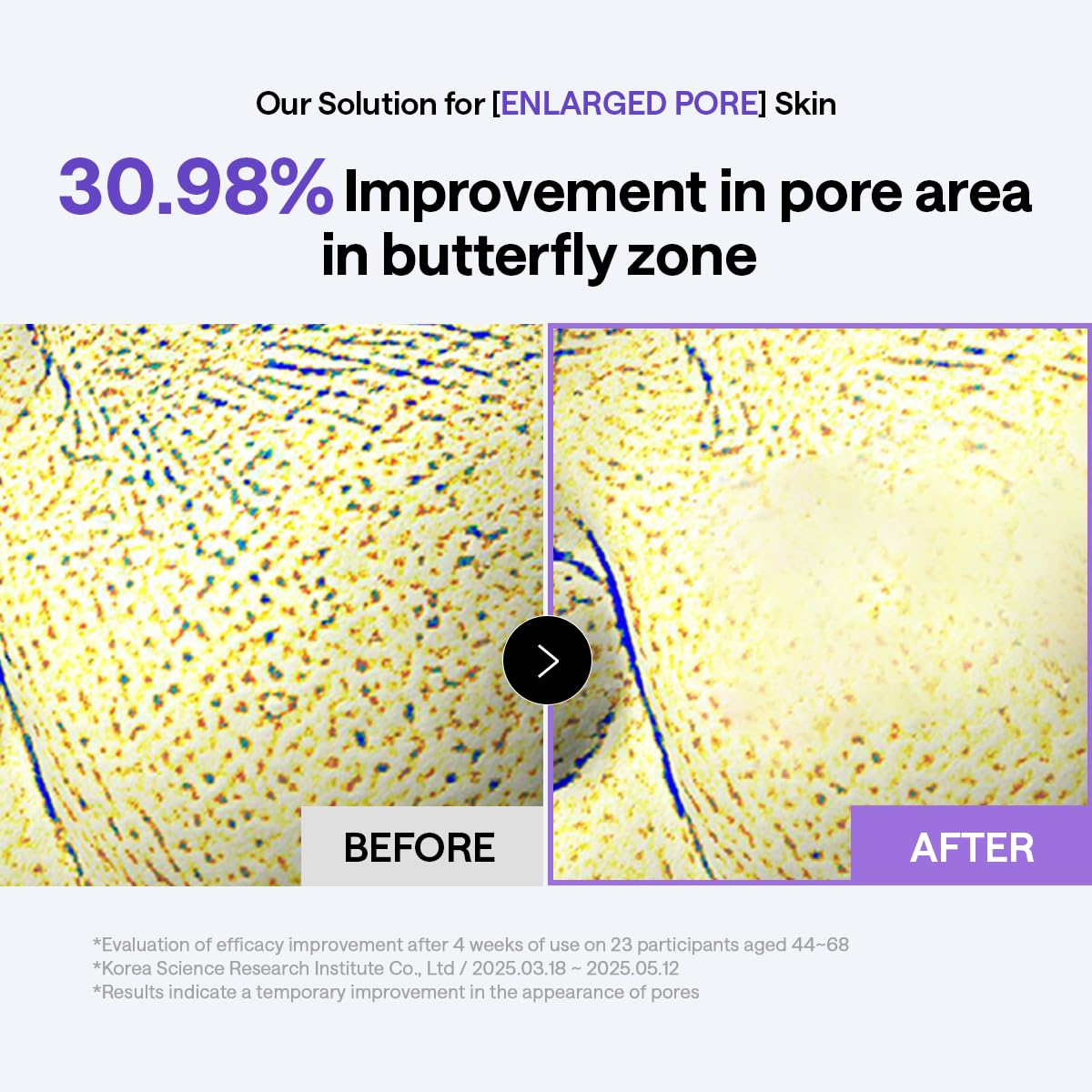 MEDIHEAL PDRN Lifting Toner Pads Pore Wrinkle Care - MEDIHEAL Official Imagery - 5