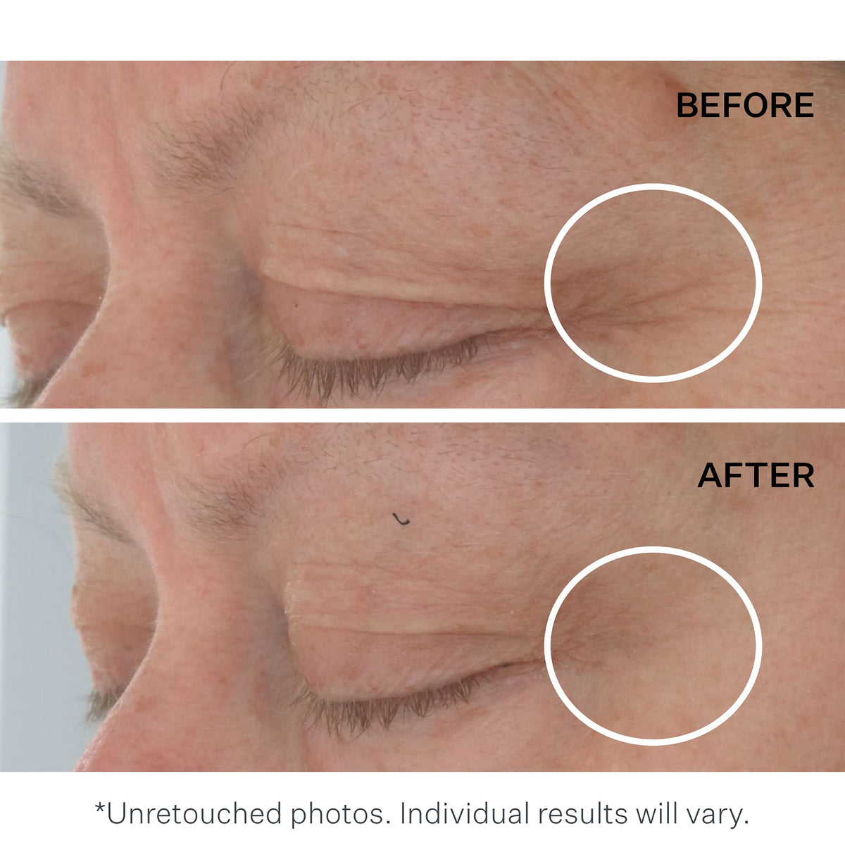 StriVectin Advanced Acids Hyaluronic Tripeptide Gel Cream - StriVectin Official Imagery - 6