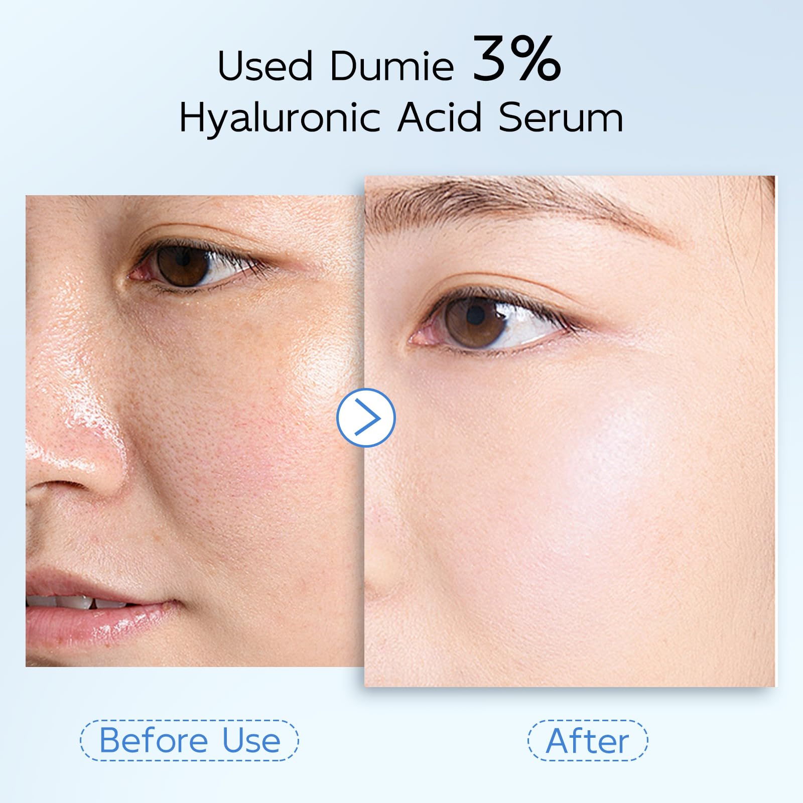 3 Hyaluronic Acid Serum for Face Anti Aging Hydrating Serum - Dumie Official Imagery - 8
