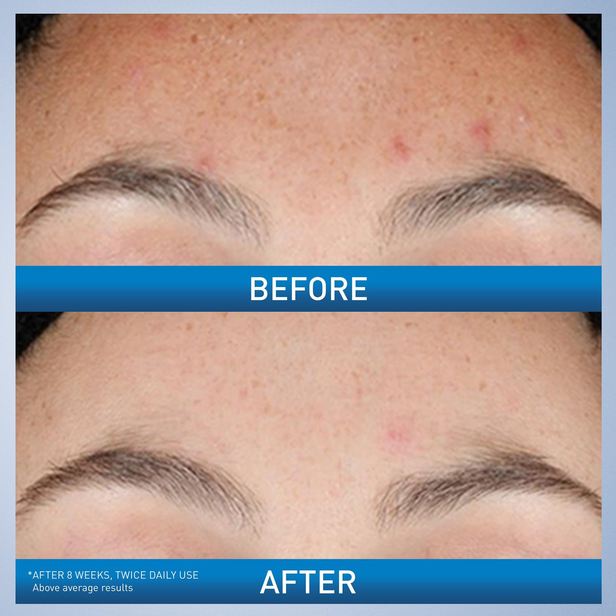 CeraVe Resurfacing Retinol Face Serum with Niacinamide, Pore M... - CeraVe Official Product View 4