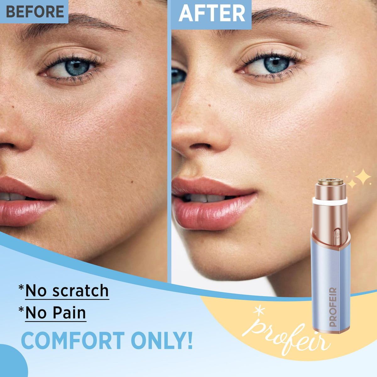Facial Hair Removal for Women Electric Hair Removal Device - Profeir Official Imagery - 4