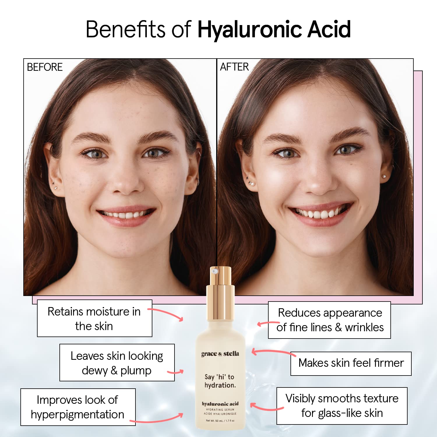 grace &amp; stella Award Winning Hyaluronic Acid Serum (50ml/1.7 - grace &amp; stella