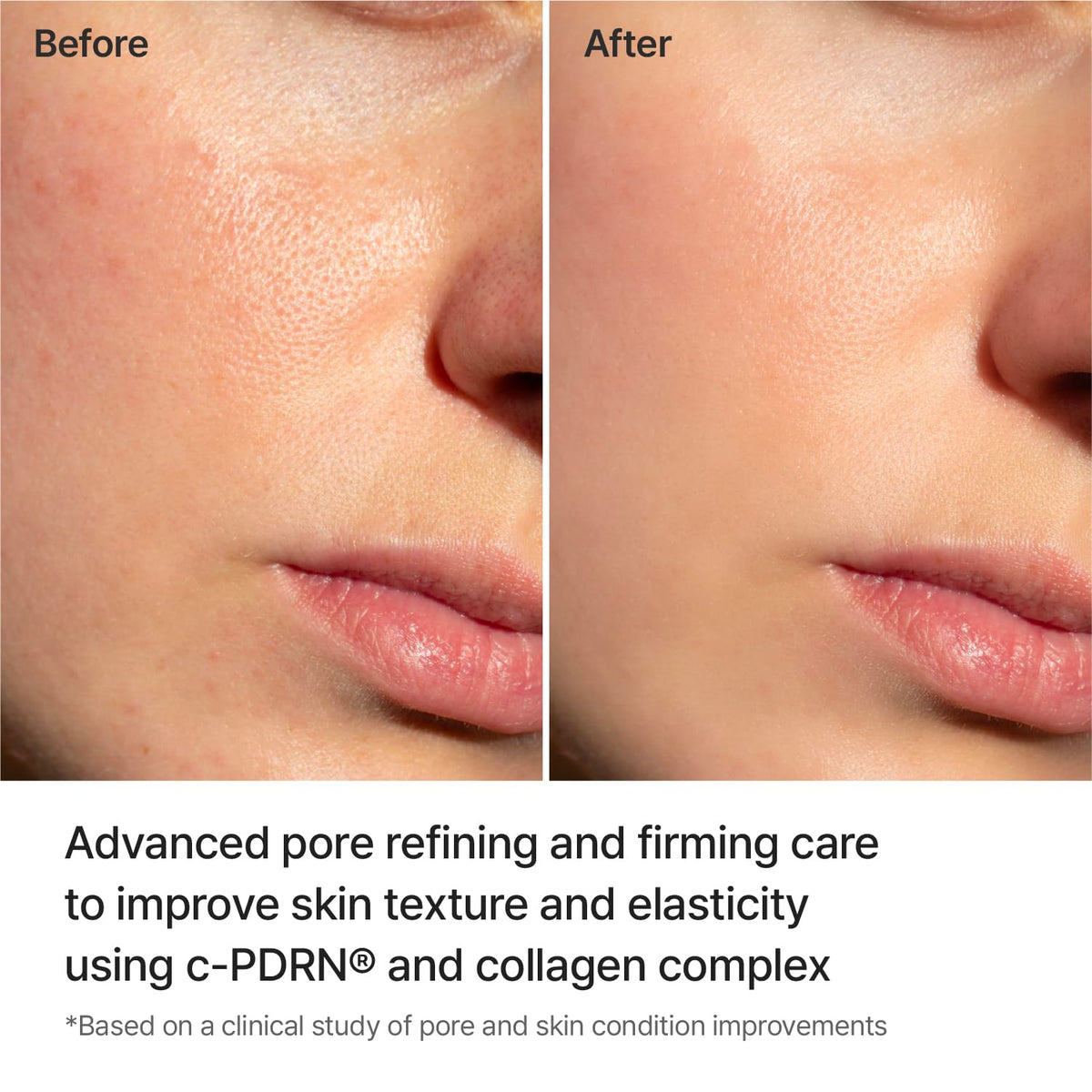 REJURAN Pore Tightening Gel Mask DOT c PDRN Hydrogel 5 Count - REJURAN Official Imagery - 5