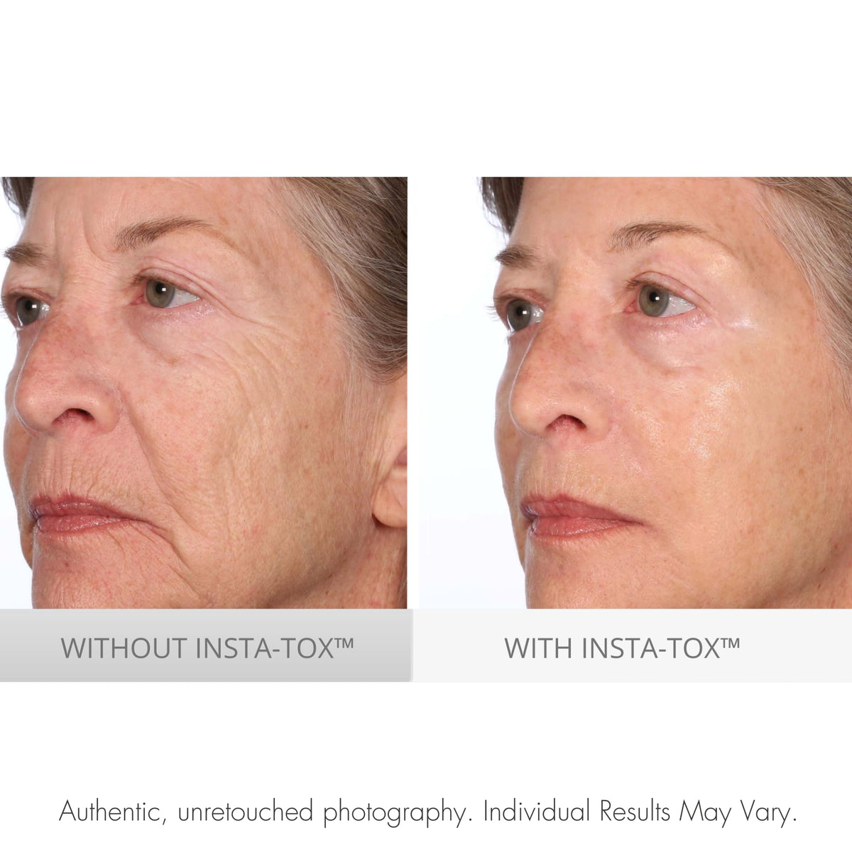Serious Skincare INSTA TOX Instant Wrinkle Filler Face Serum - Serious Skincare Official Imagery - 7