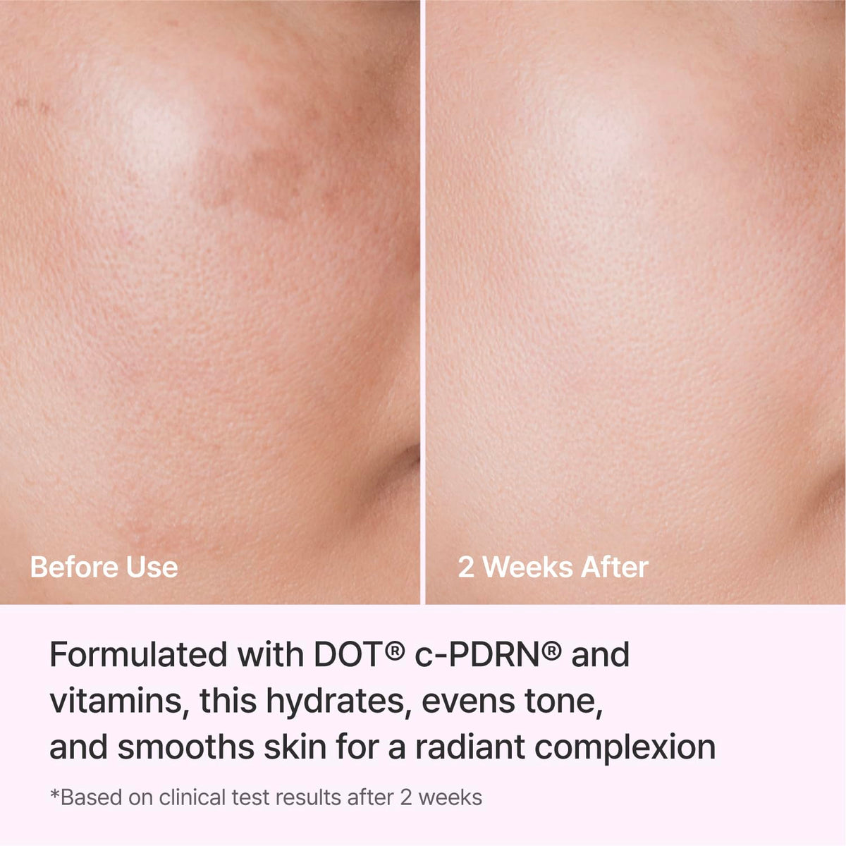 REJURAN Triple Radiance Cream DOT c PDRN 0 2 Moisturizer 1 - REJURAN Official Product Imagery - 6