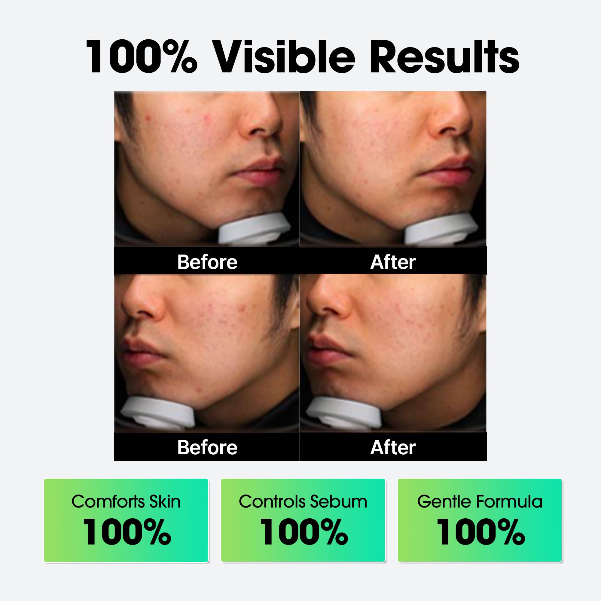 SOME BY MI AHA BHA PHA 30 Days Miracle Cream - 2.02oz, 60ml - Mild Refining & Centella Face Moisturizer for All Skin Types - Clarifying Face Cream - Korean Skin Care - SOME BY MI Official Product View 9