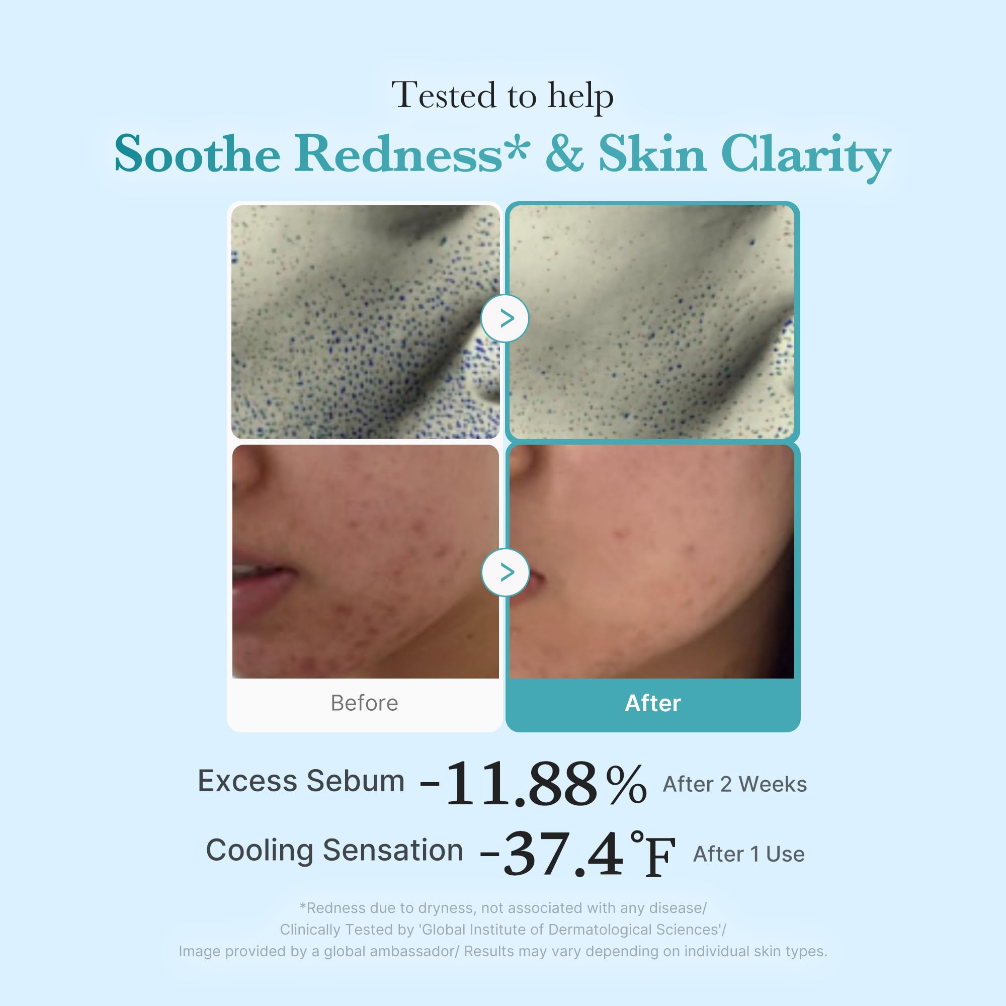 medicube Azelaic Acid Niacinamide Clarifying Toner - medicube