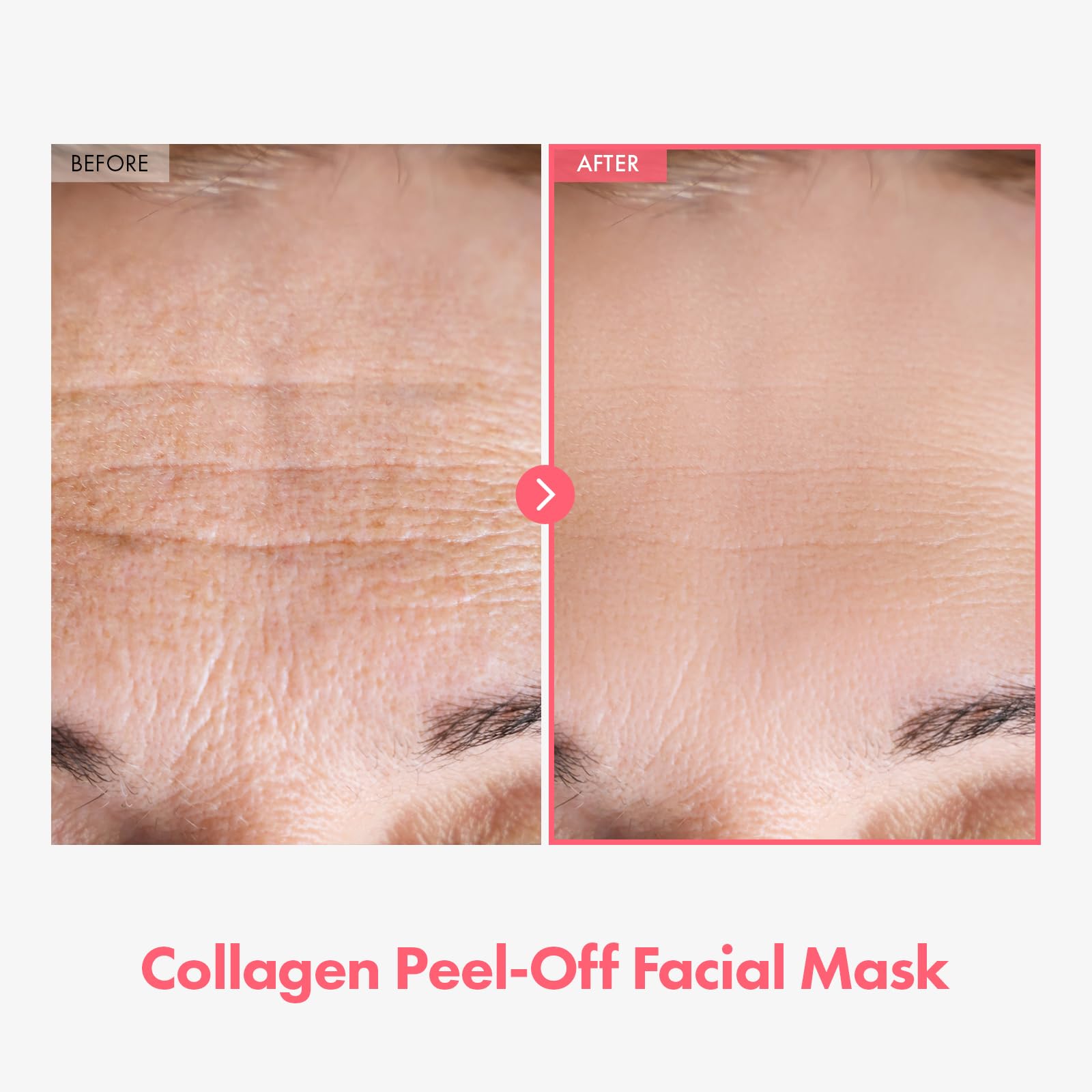 TOSOWOONG Real Collagen Fit, Easy Peel-Off Mask for Firming, - TOSOWOONG
