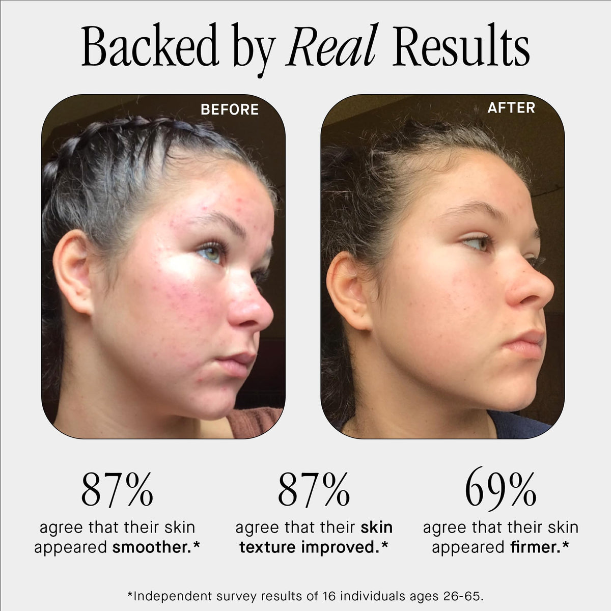 Brandefy No Needles Niacinamide Peptide Hyaluronic Acid Face - Brandefy Official Imagery - 4