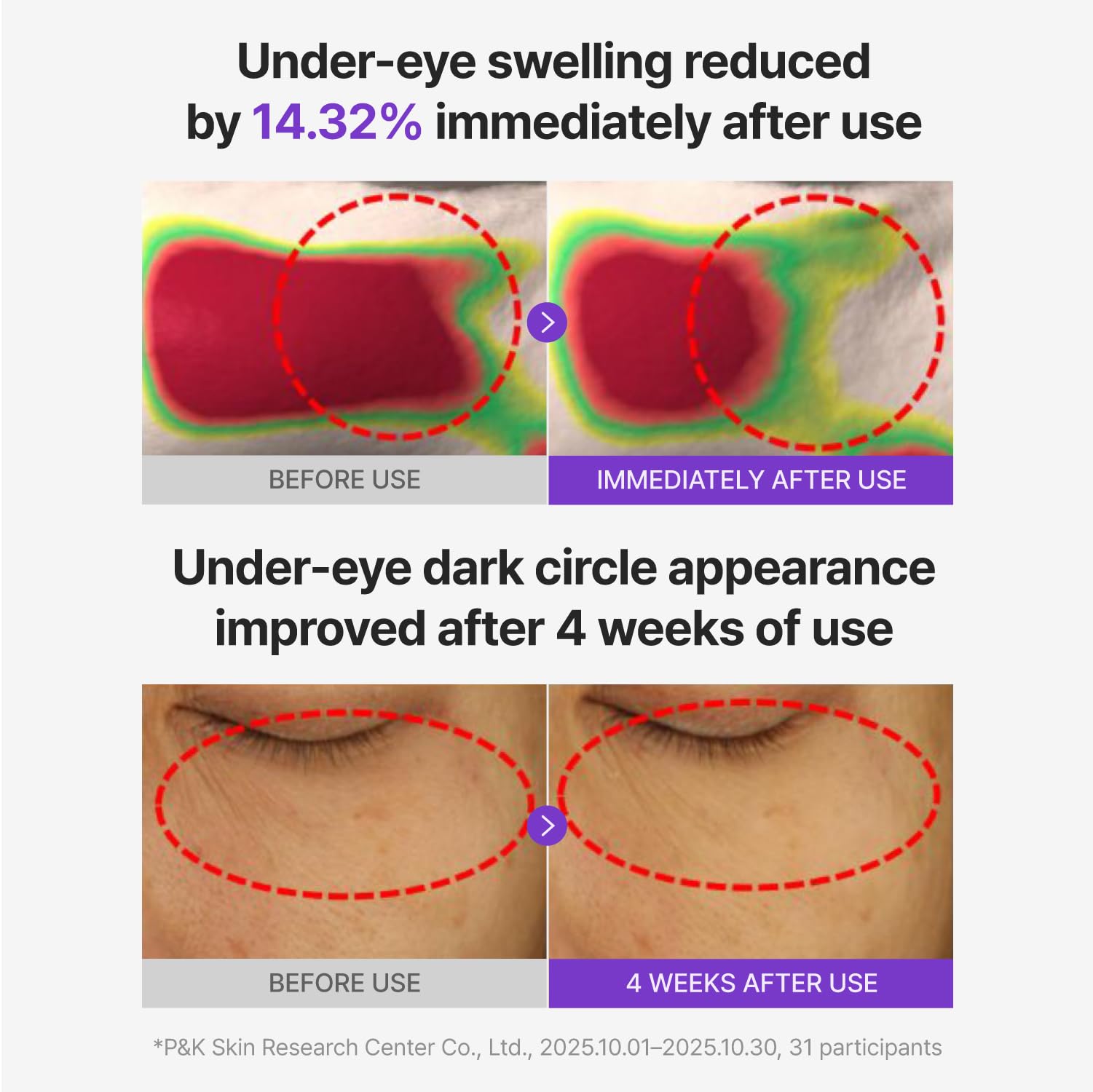 CENTELLIAN 24 360 Shot PDRN Glowing Eye Patch TECA Dark - CENTELLIAN 24 Official Imagery - 5