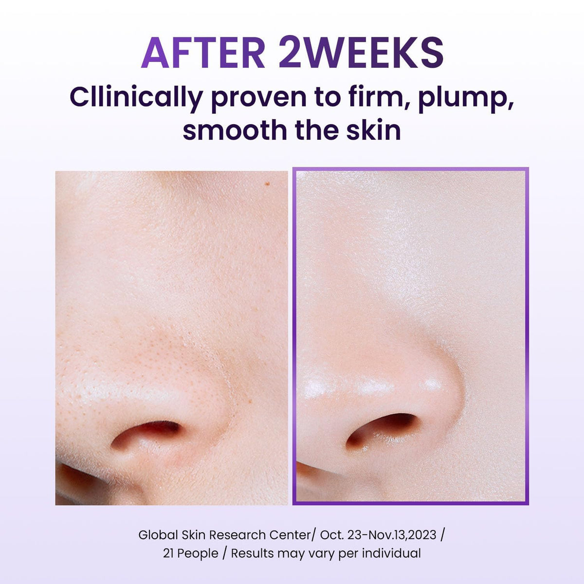 BIOHEAL BOH Probioderm Collagen Remodeling Cream 1 01 fl oz - BIOHEAL BOH Official Imagery - 4