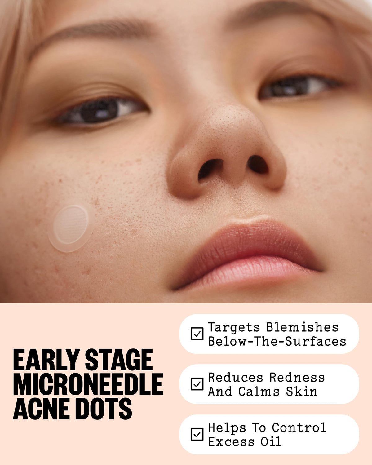 PEACE OUT Early Stage Acne Microneedling Hydrocolloid Dots - PEACE OUT Official Imagery - 4