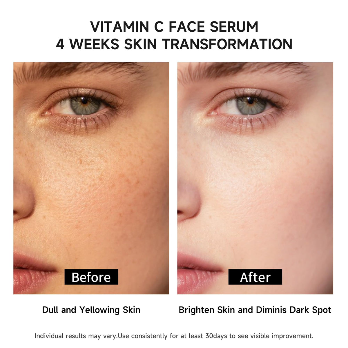 Vitamin C Face Serum with Glutathione 4D Hyaluronic Acid - BACHERI Official Imagery - 4