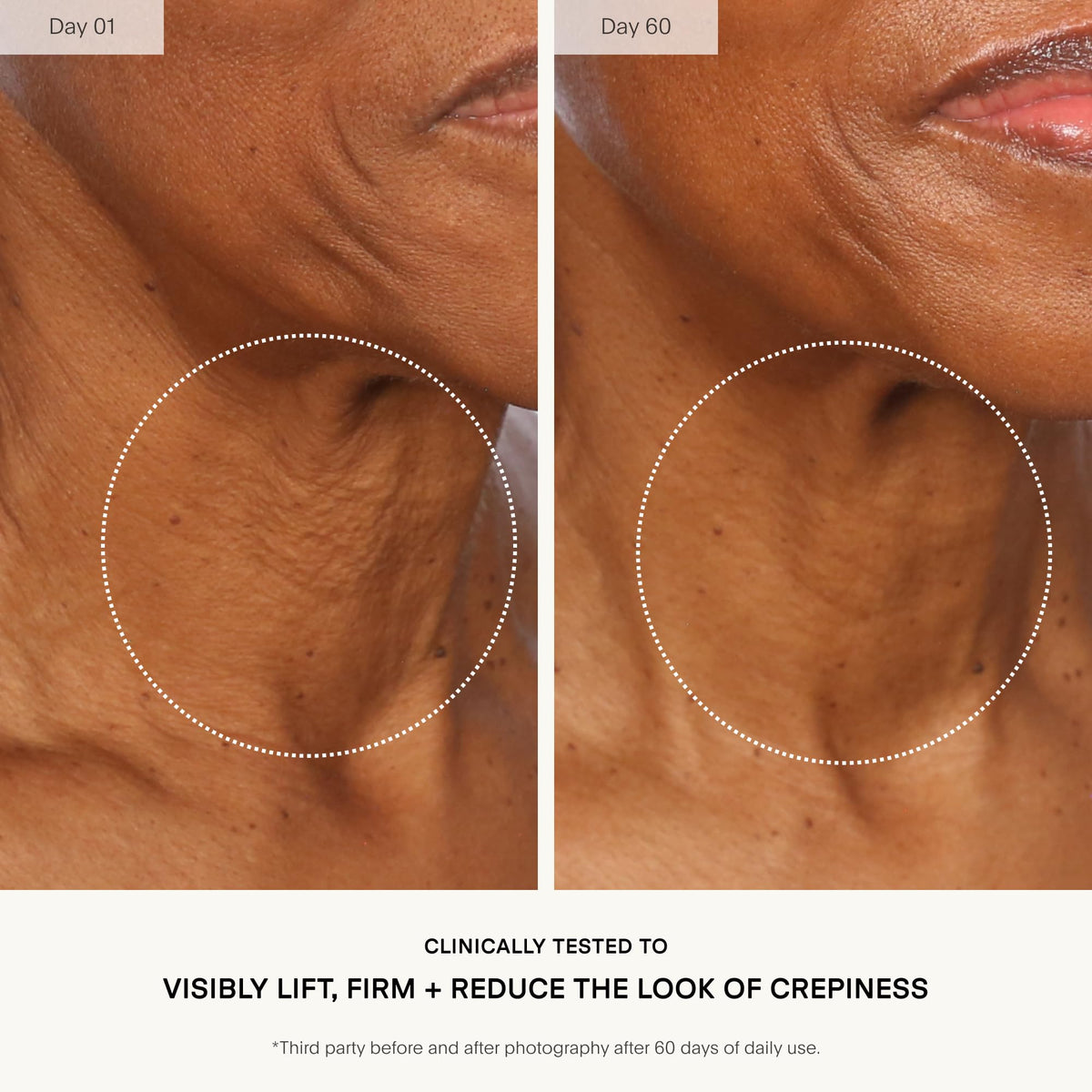 U Beauty The Sculpt Neck D collet Concentrate - U Beauty Official Imagery - 5