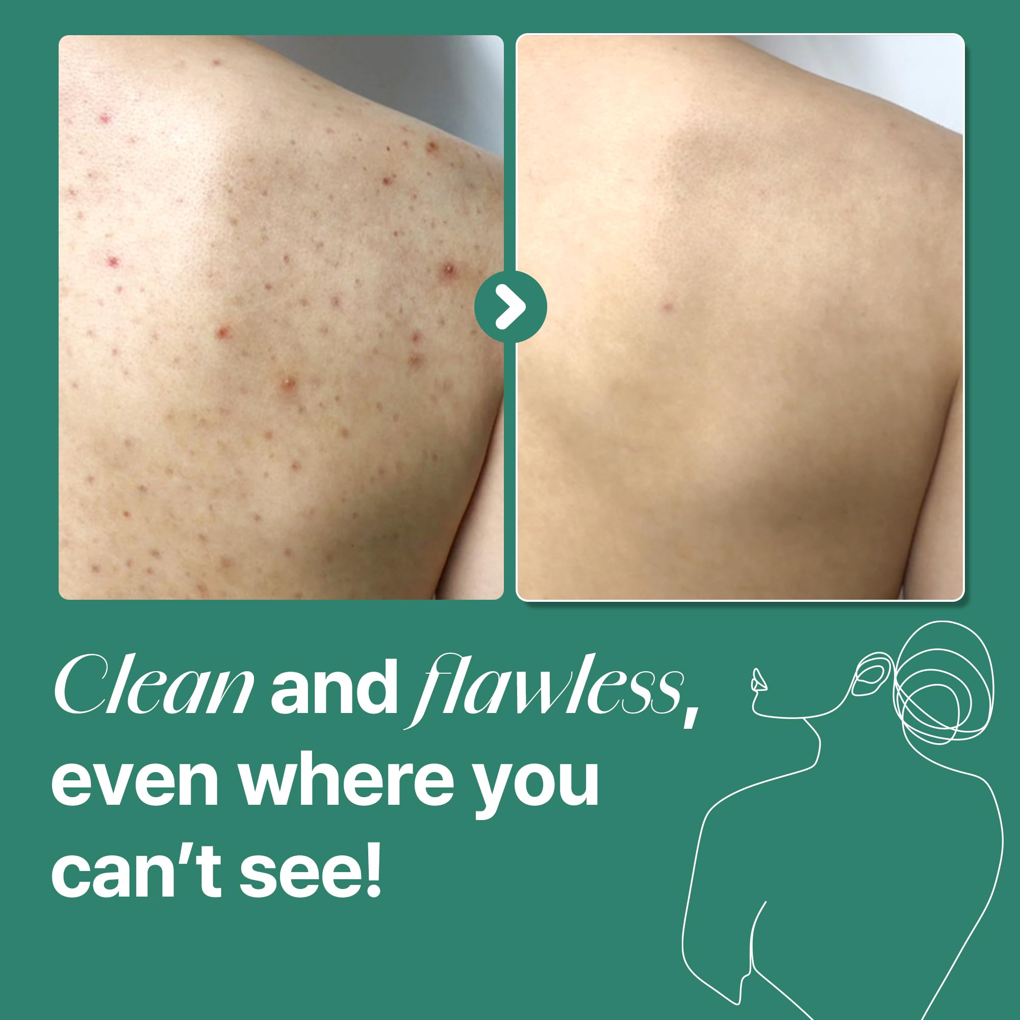 SOME BY MI AHA BHA PHA 30 Days Miracle Acne Clear Body Cleanser - View 7