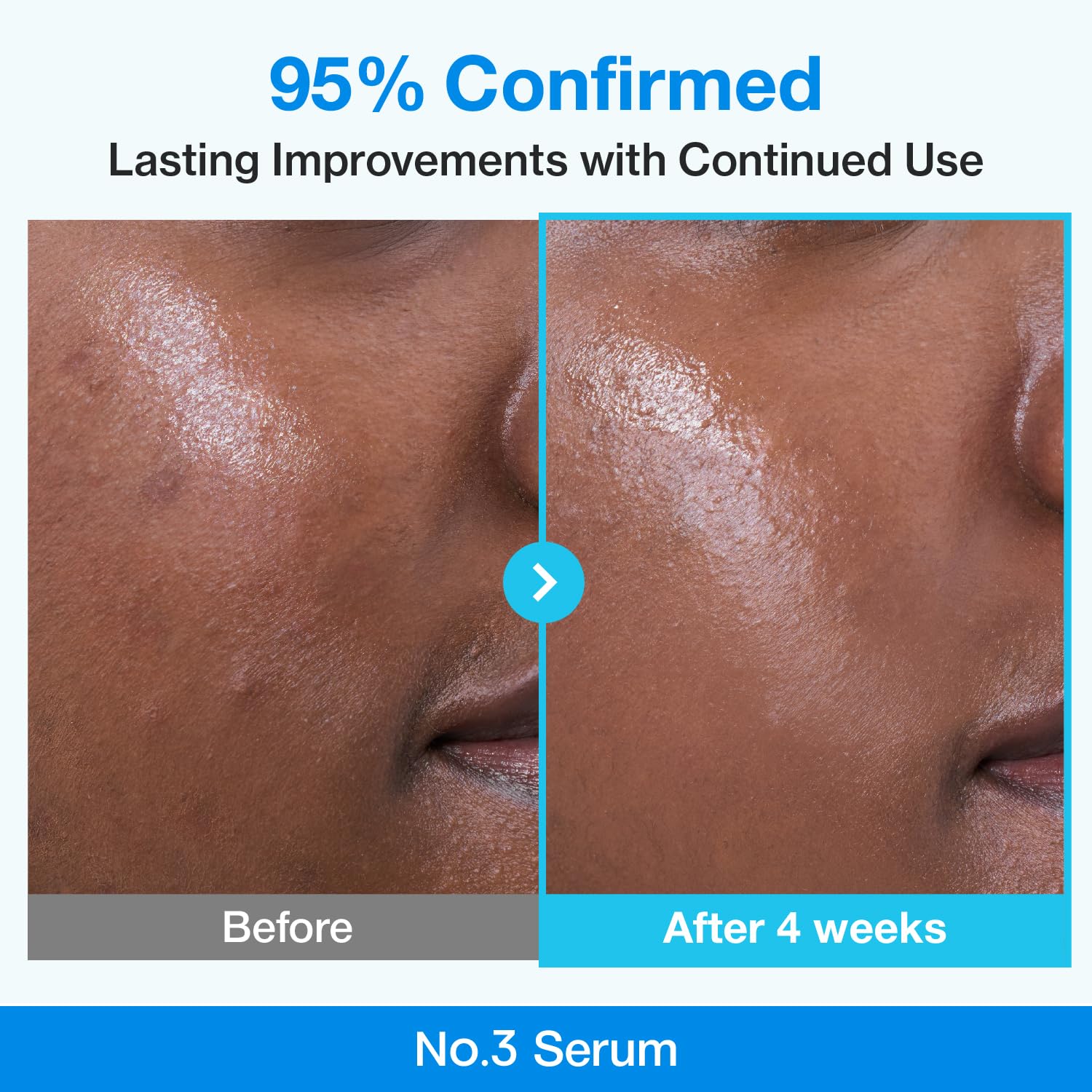 numbuzin No 3 retinol Serum - numbuzin Official Imagery - 5