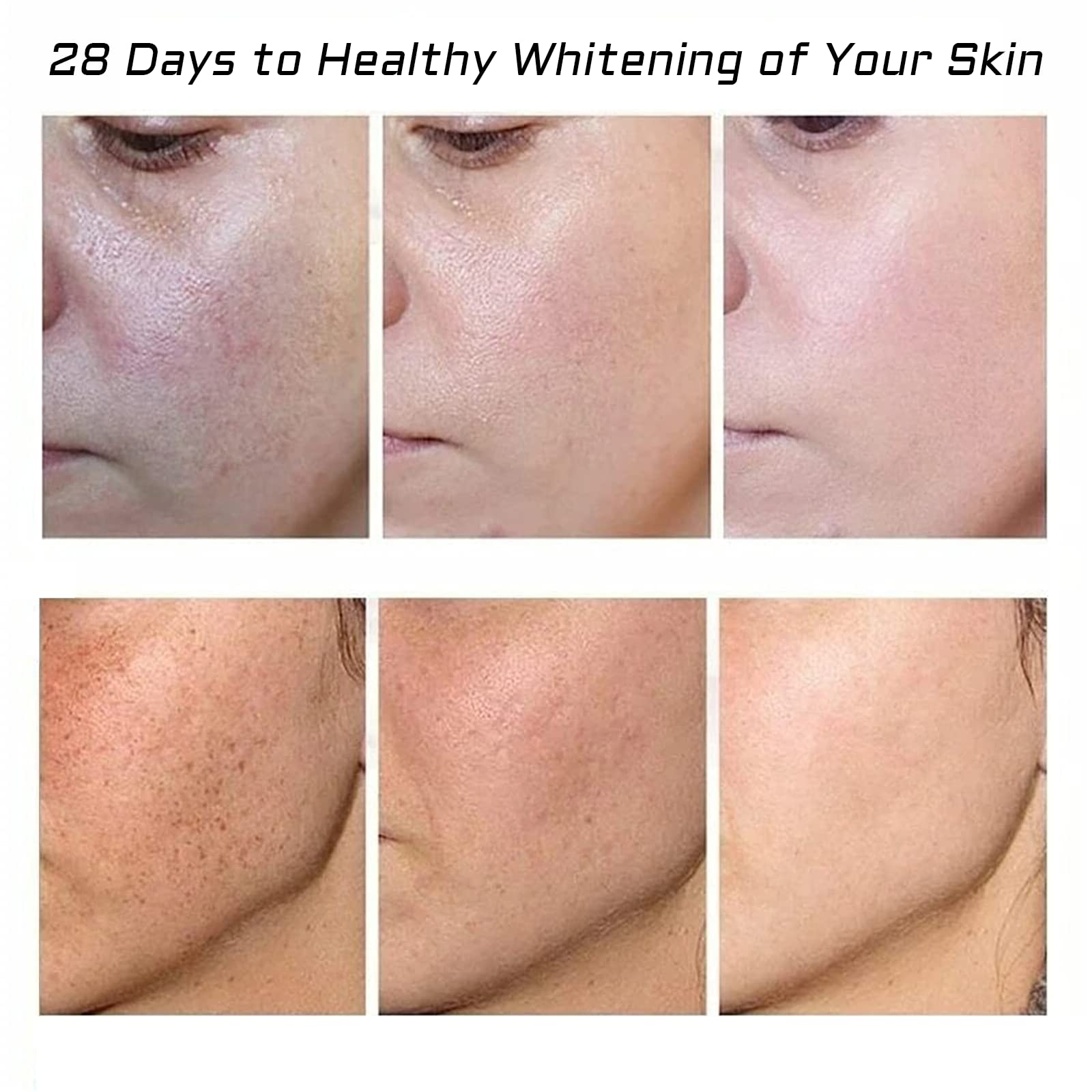 Fupah Whitening Freckle Cream 2-Pack – Dark Spot Remover